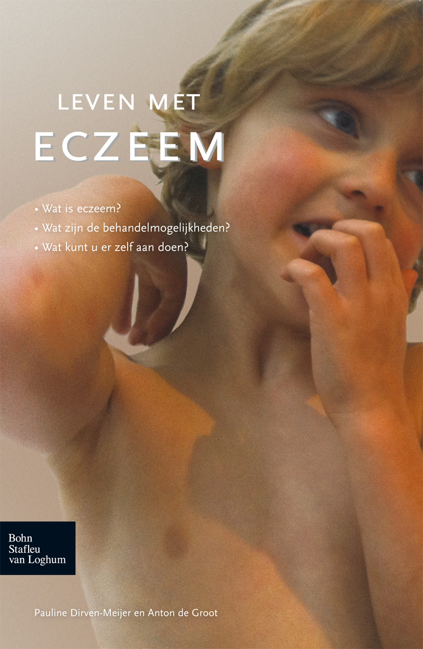 Cover Leven met eczeem