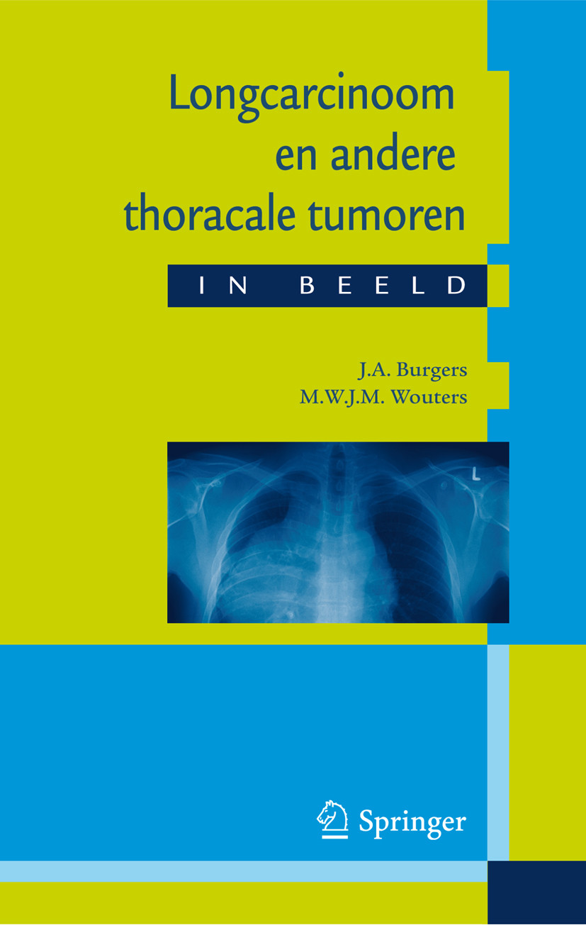 Cover Longcarcinoom en andere thoracale tumoren in beeld