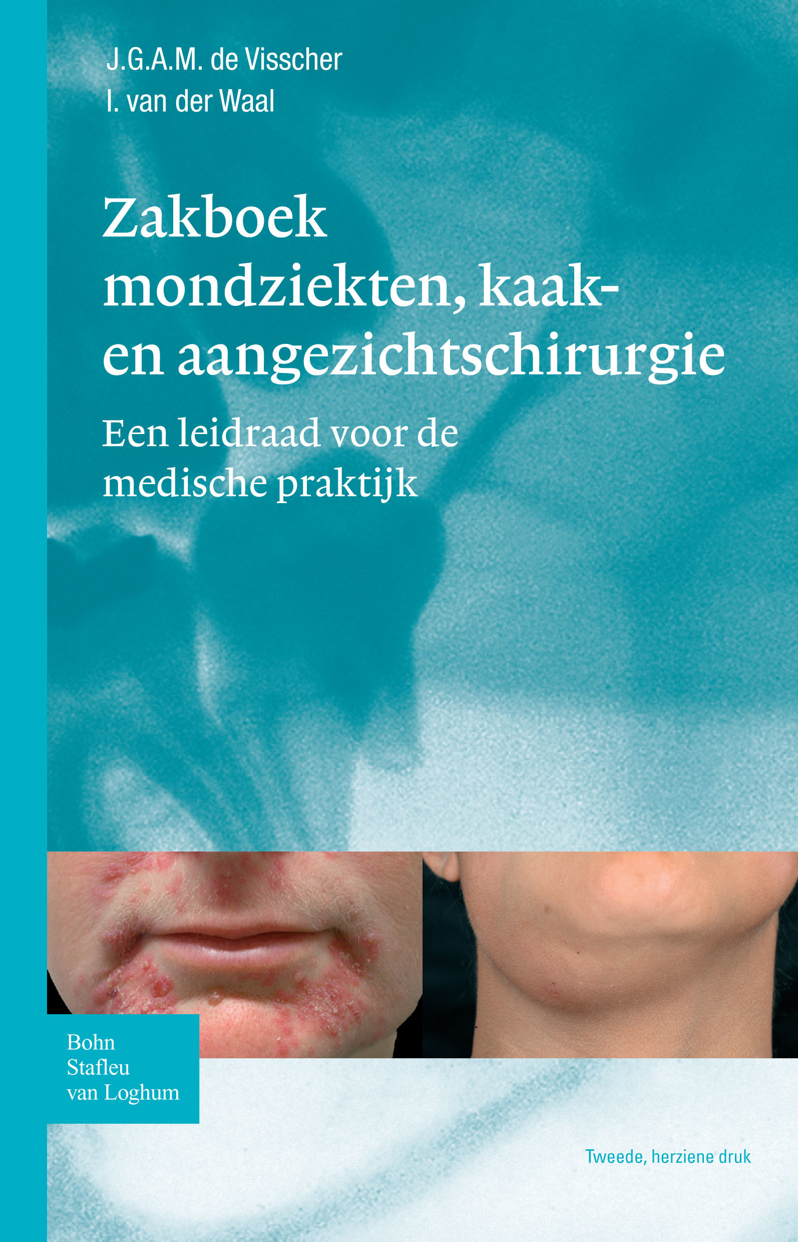 Cover Zakboek mondziekten, kaak- en aangezichtschirurgie