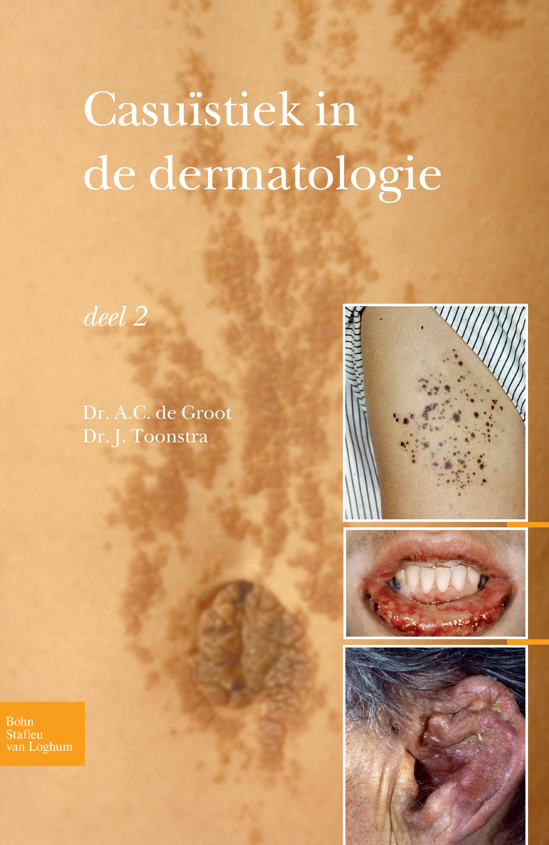 Cover Casuïstiek in de dermatologie - deel 2
