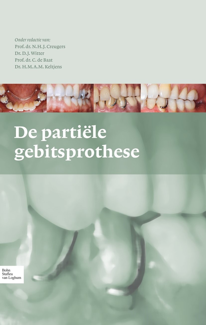 Cover De partiële gebitsprothese