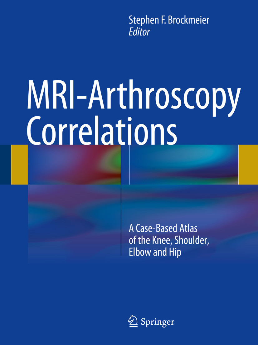 Cover MRI-Arthroscopy Correlations