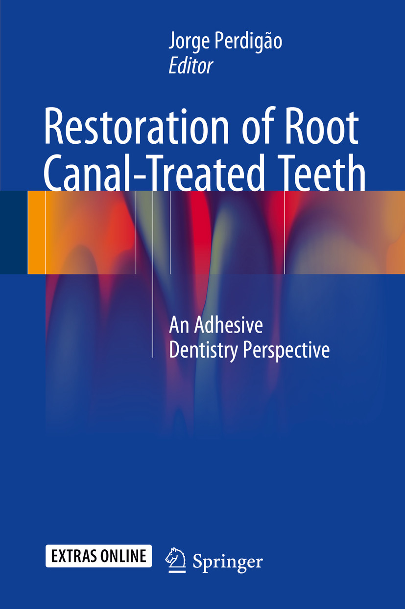 Cover Restoration of Root Canal-Treated Teeth
