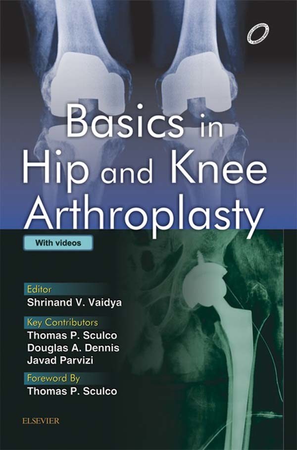 Cover Basics in Hip and Knee Arthroplasty