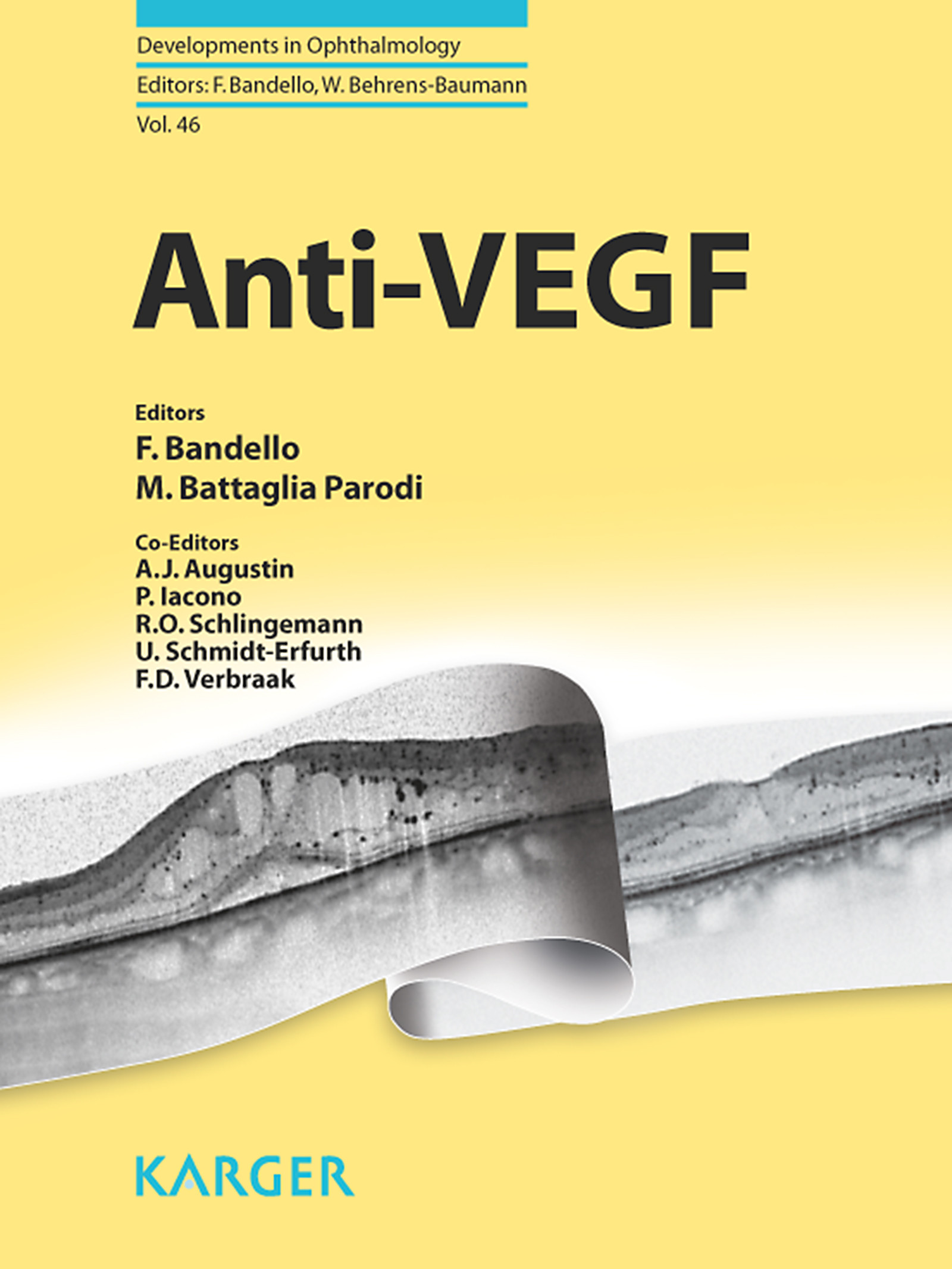 Anti-VEGF
