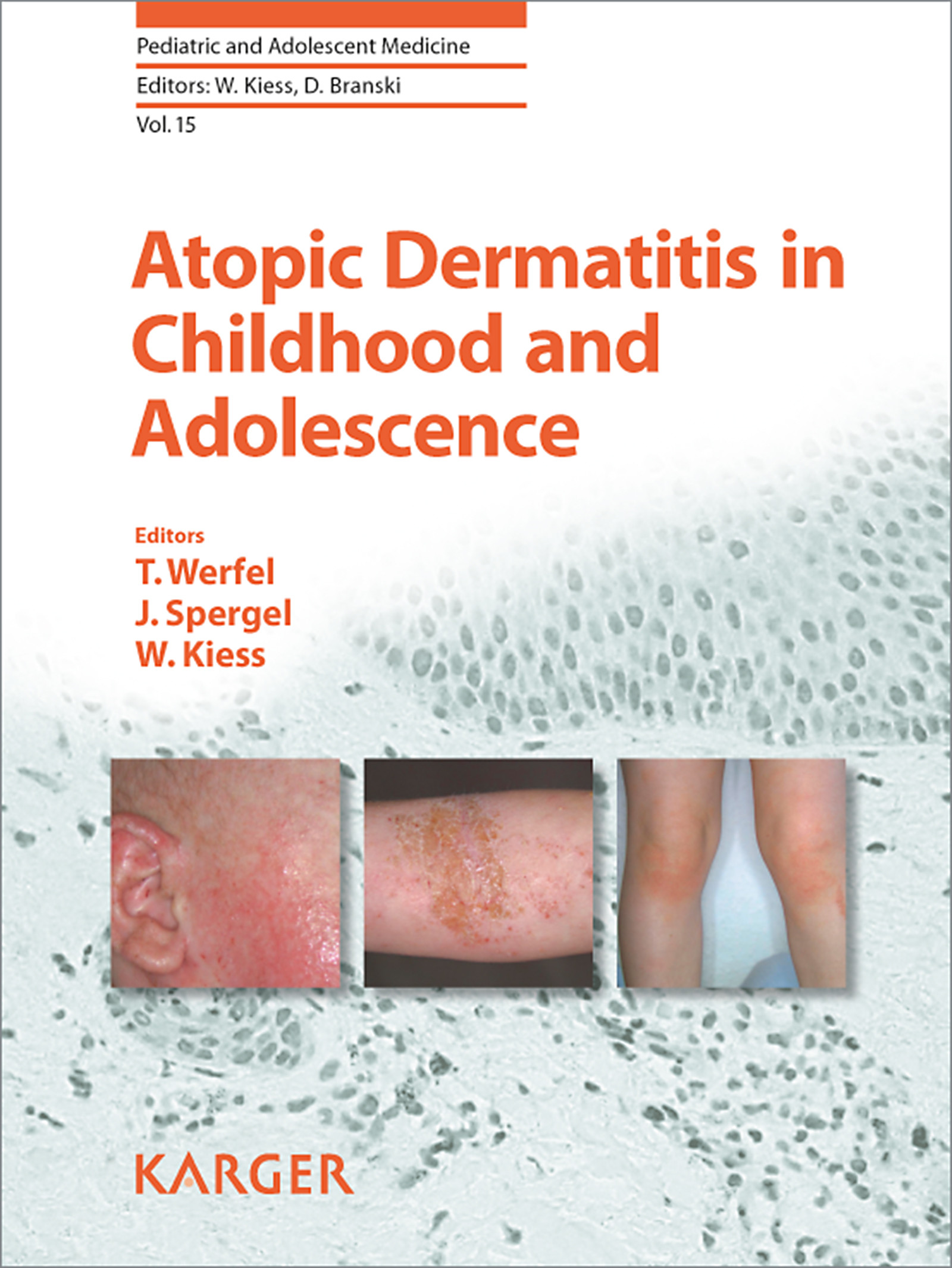 Cover Atopic Dermatitis in Childhood and Adolescence