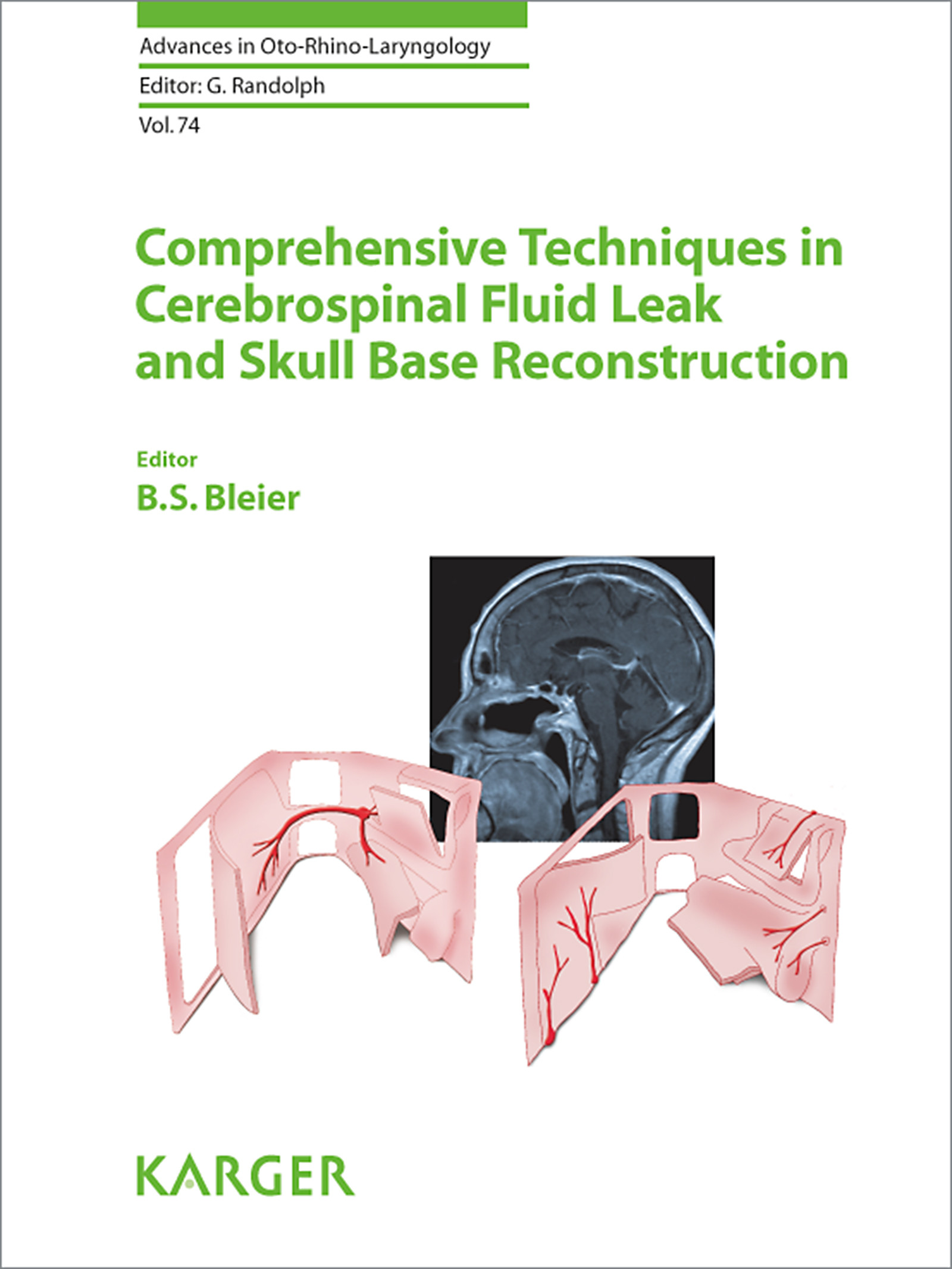 Cover Comprehensive Techniques in CSF Leak Repair and Skull Base Reconstruction