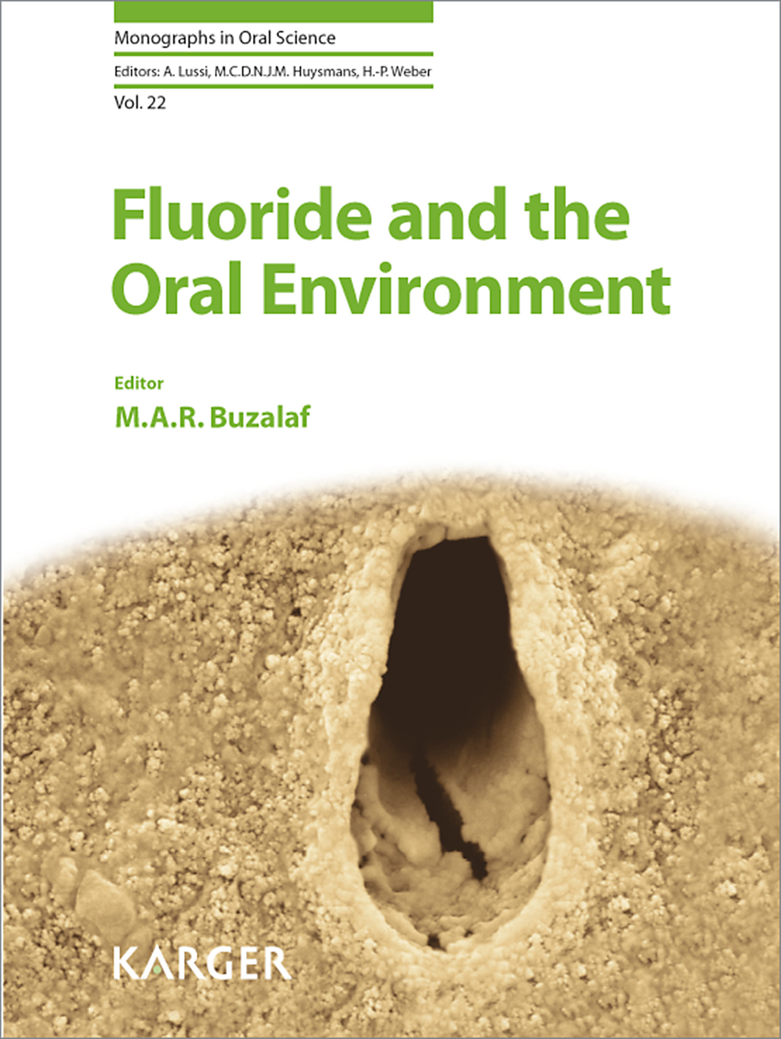 Cover Fluoride and the Oral Environment