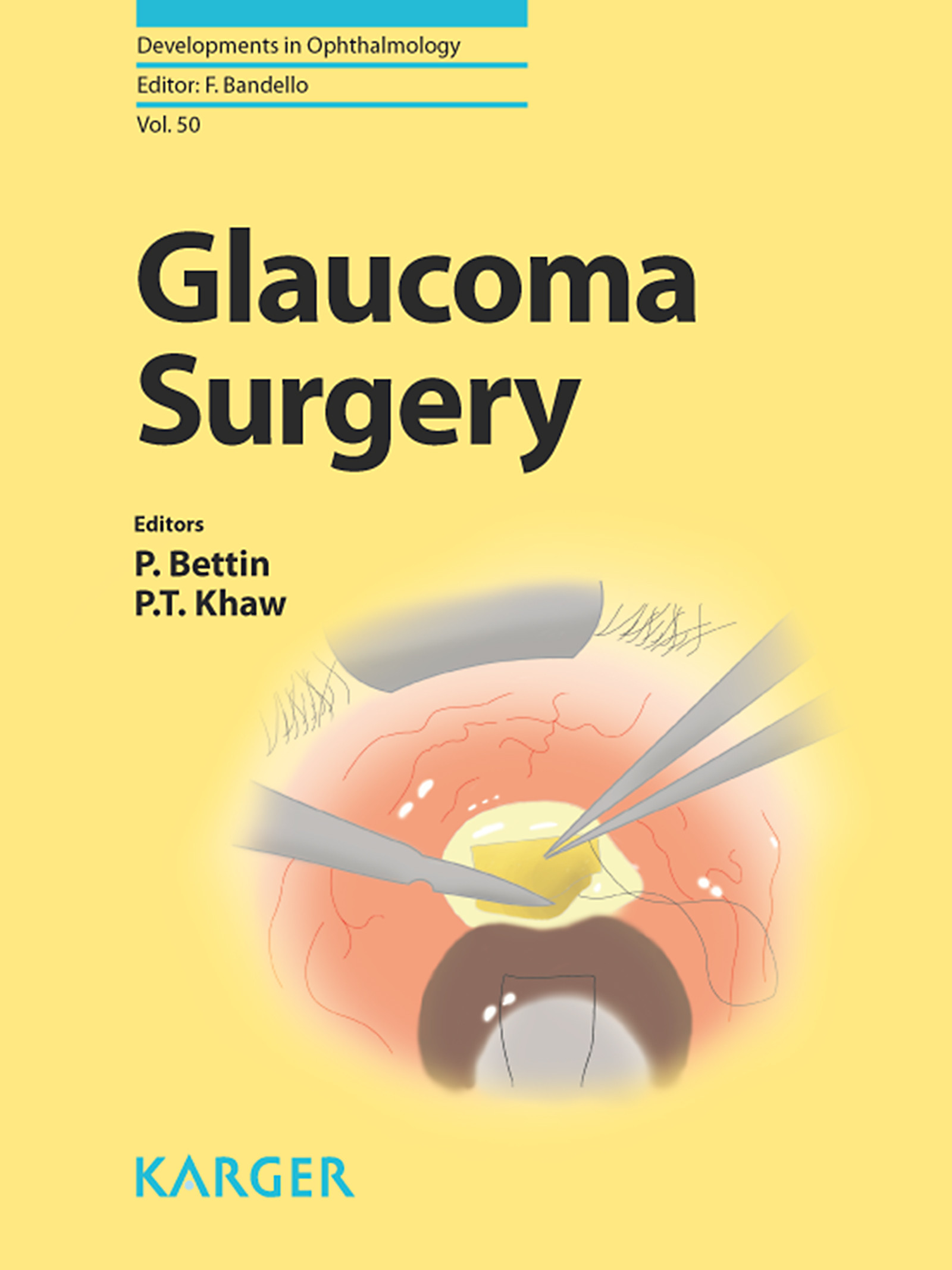 Cover Glaucoma Surgery