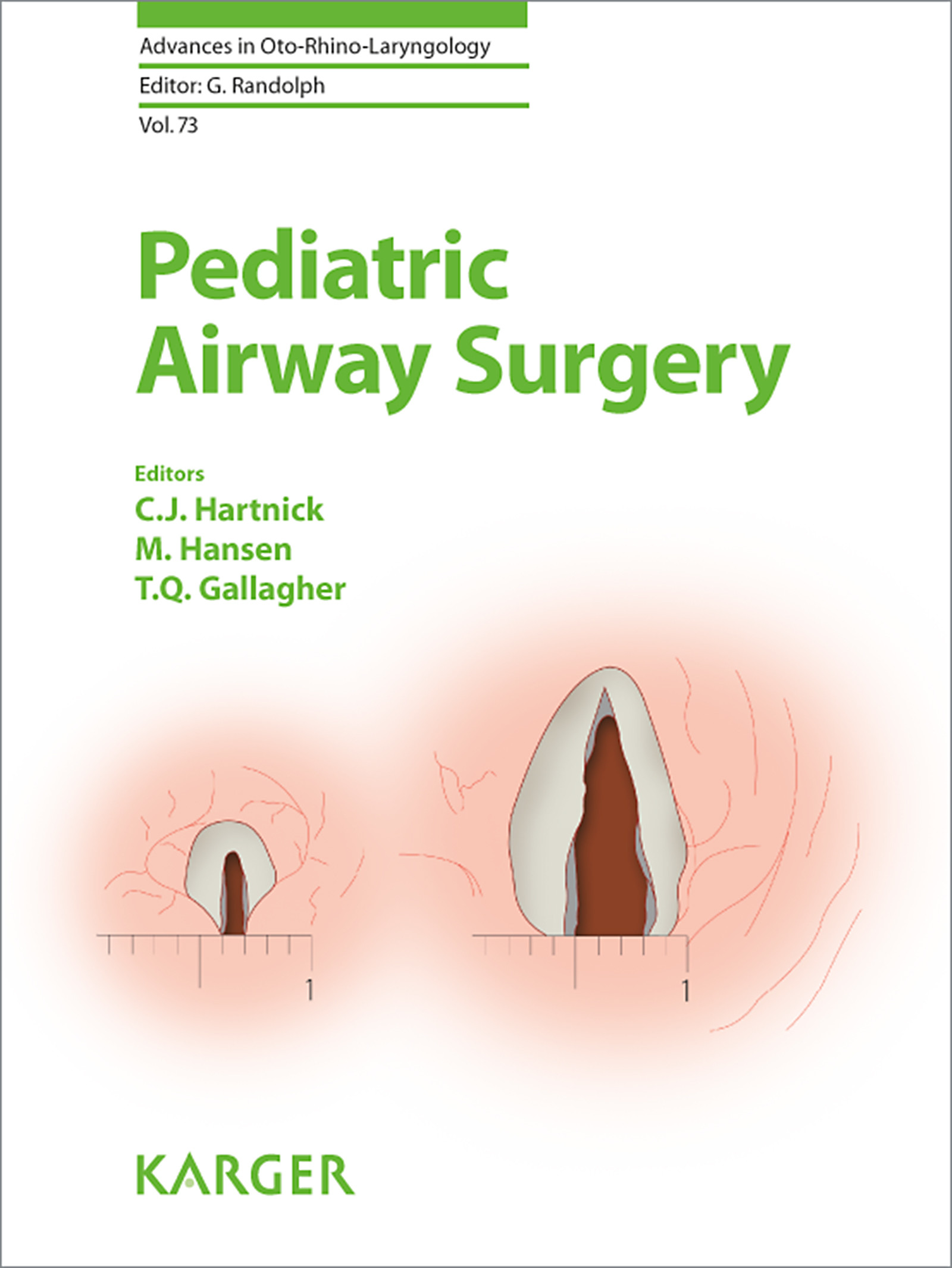 Cover Pediatric Airway Surgery