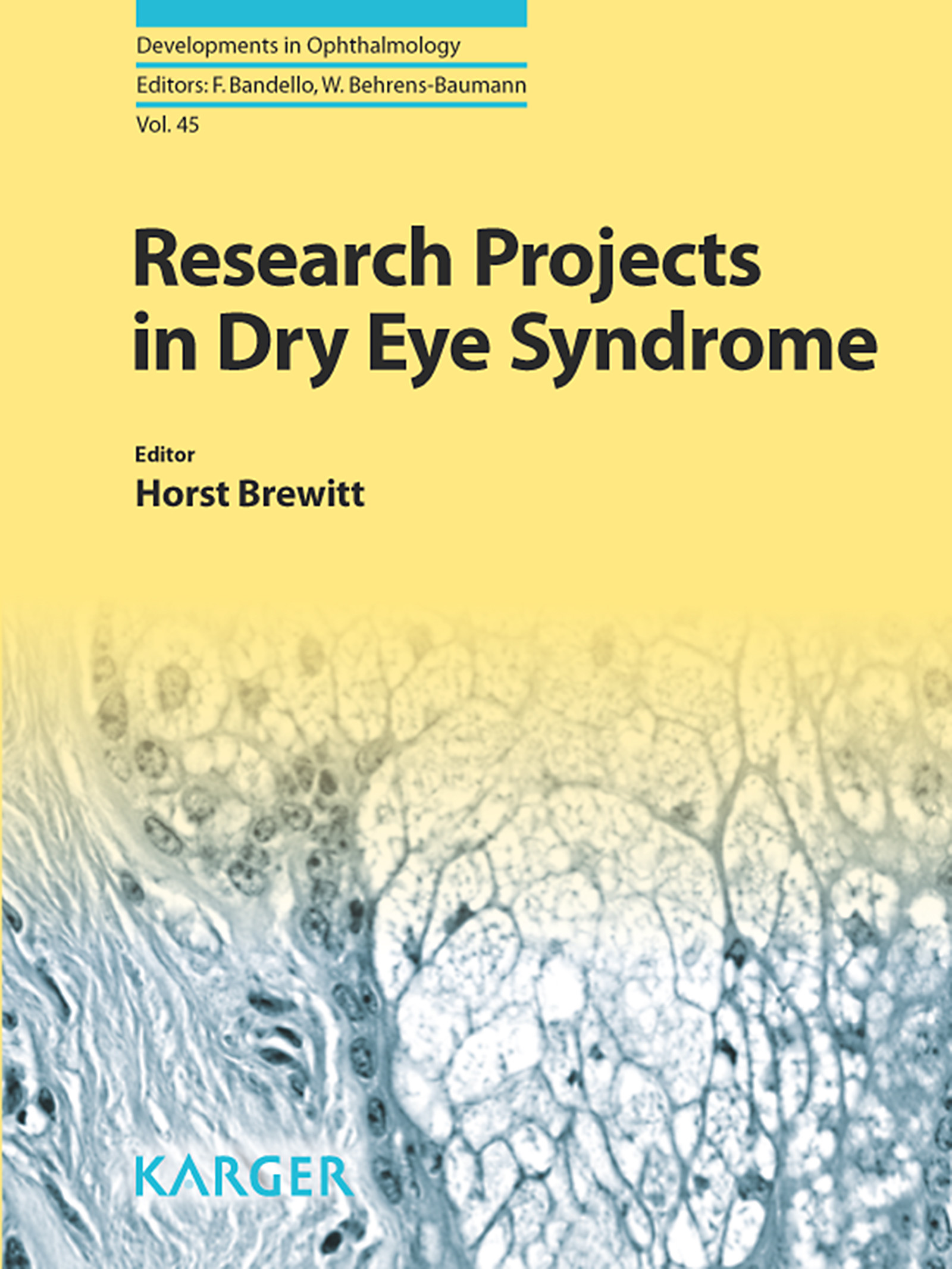 Cover Research Projects in Dry Eye Syndrome