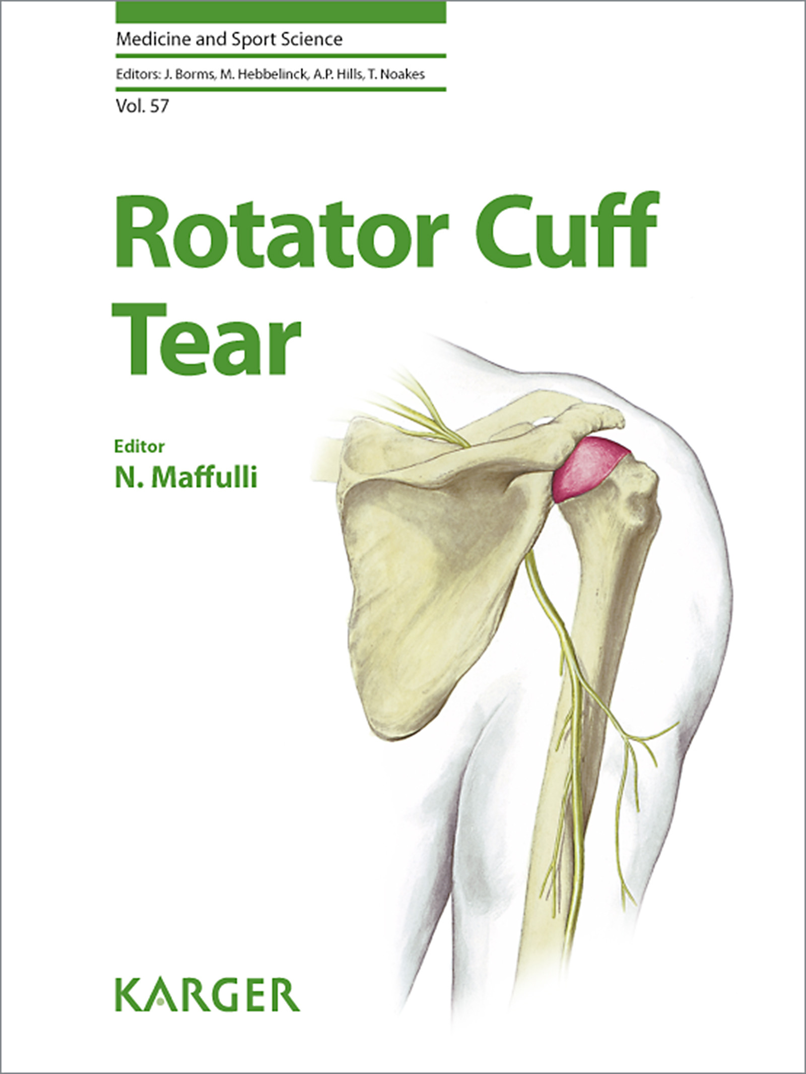 Cover Rotator Cuff Tear