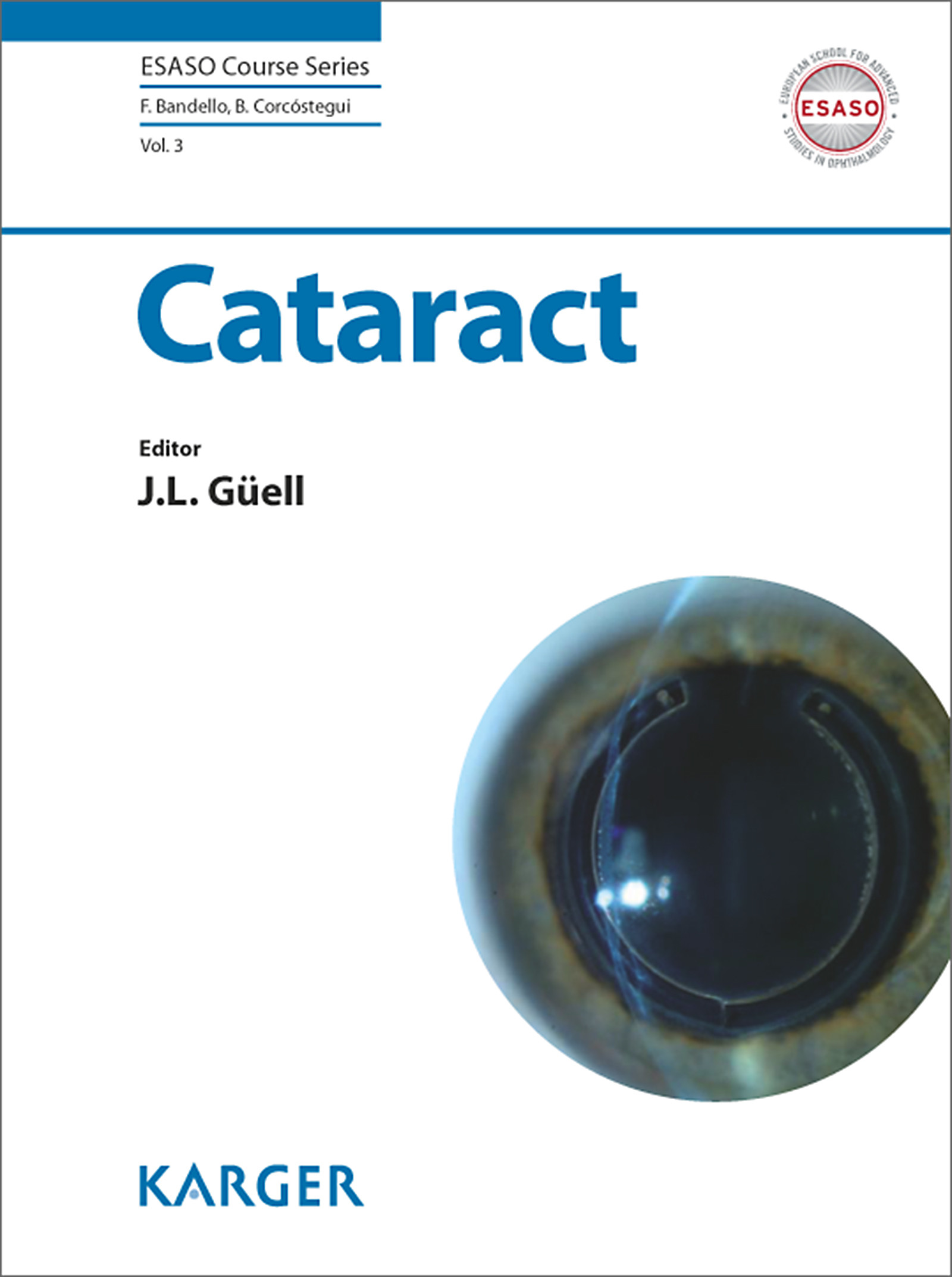 Cover Cataract