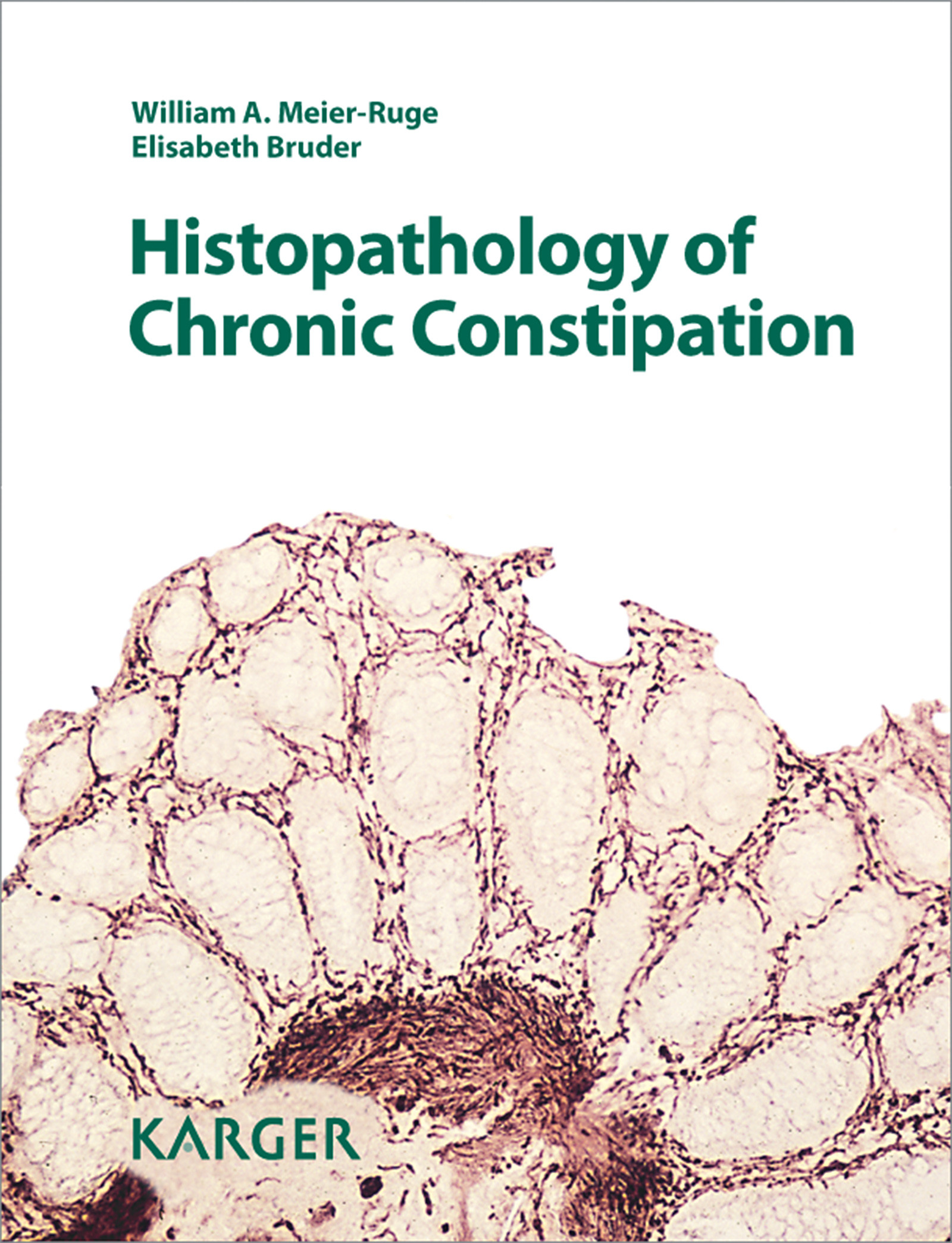 Cover Histopathology of Chronic Constipation