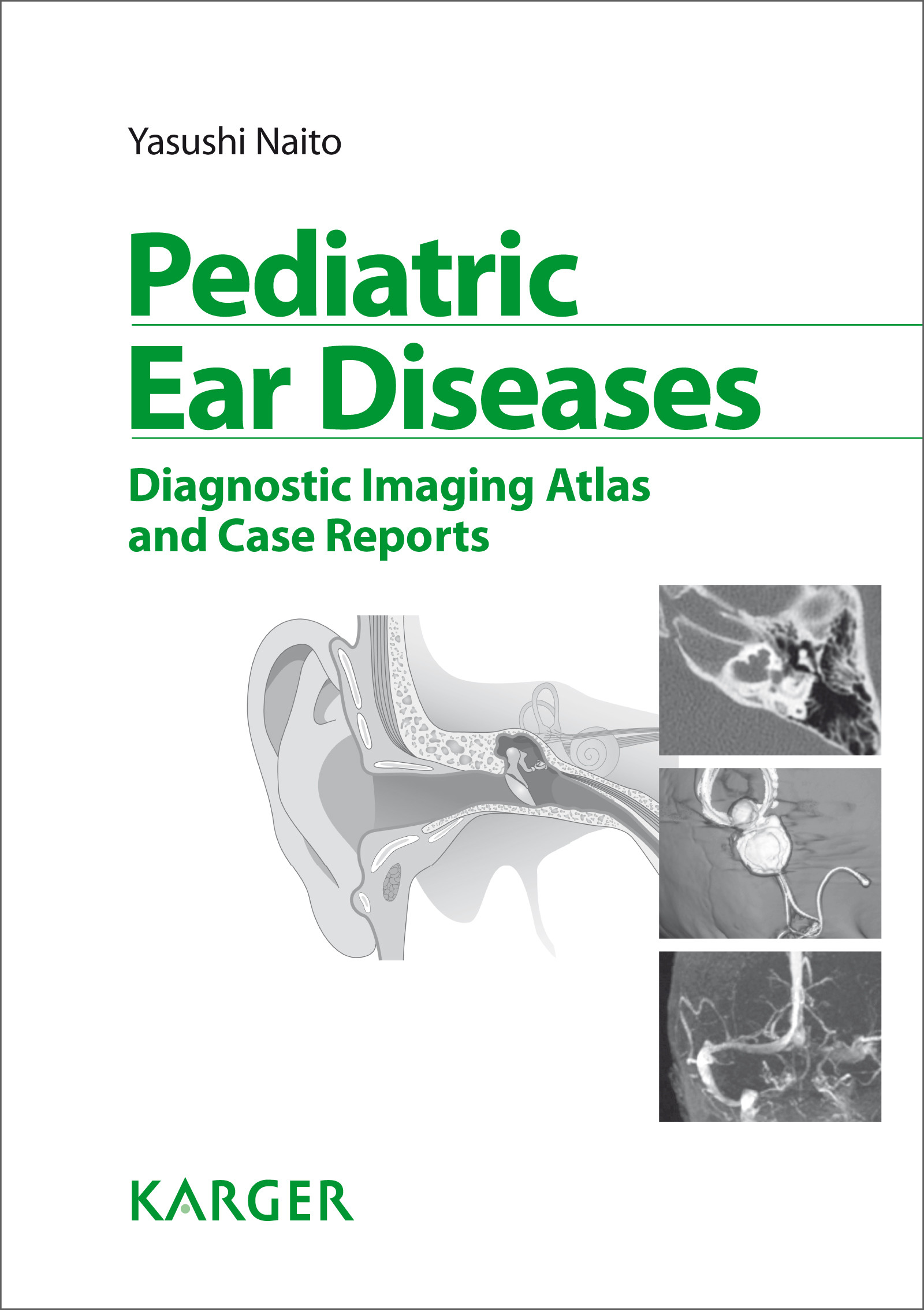 Pediatric Ear Diseases