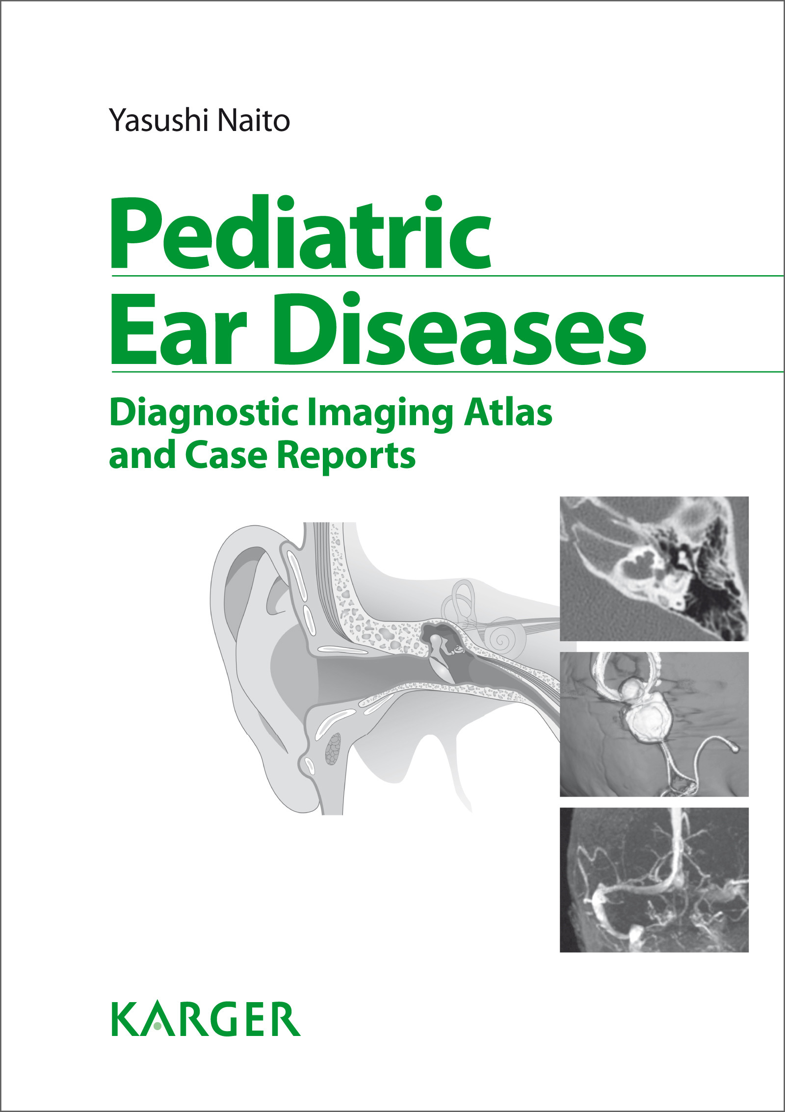 Cover Pediatric Ear Diseases
