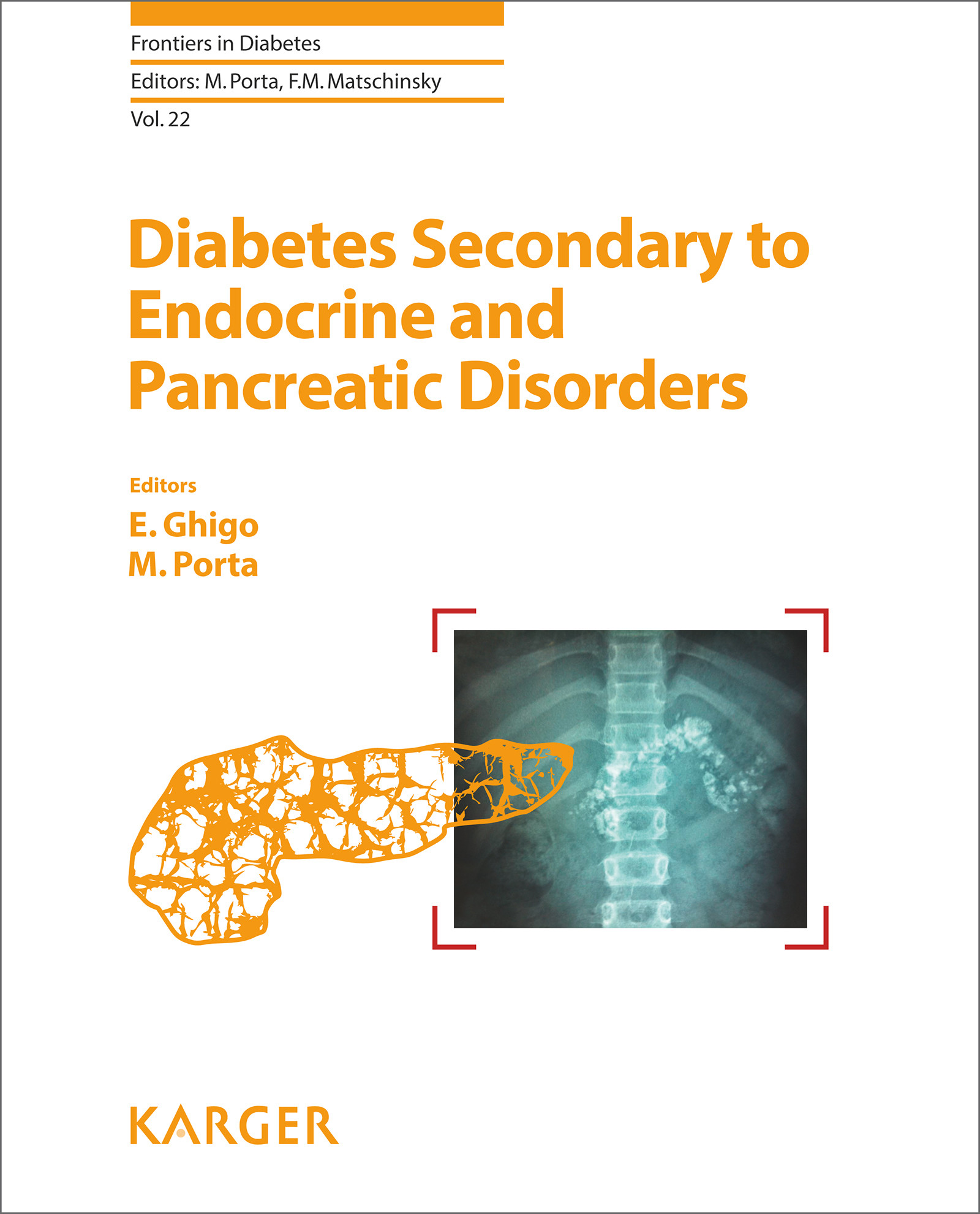Cover Diabetes Secondary to Endocrine and Pancreatic Disorders