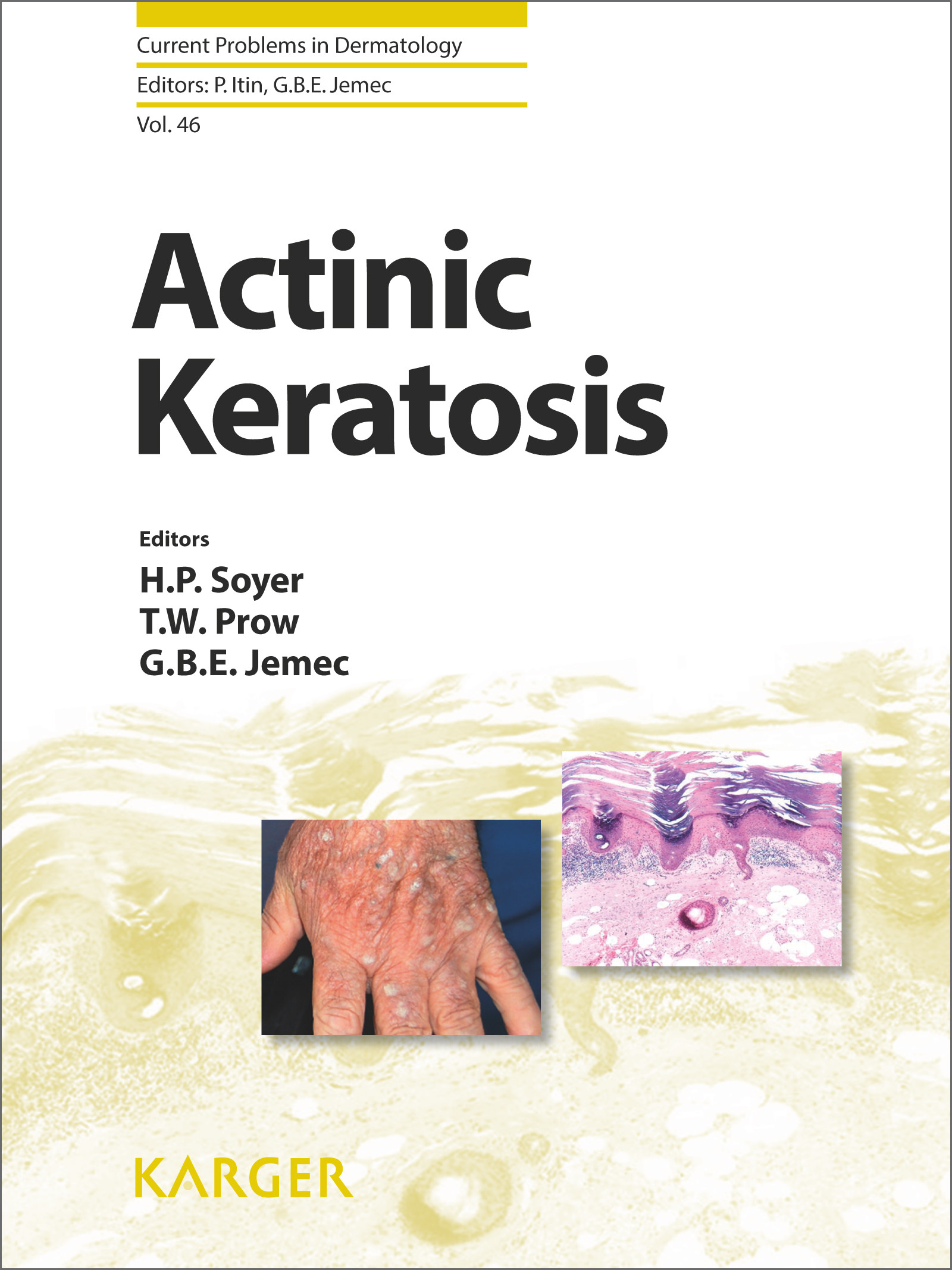 Cover Actinic Keratosis