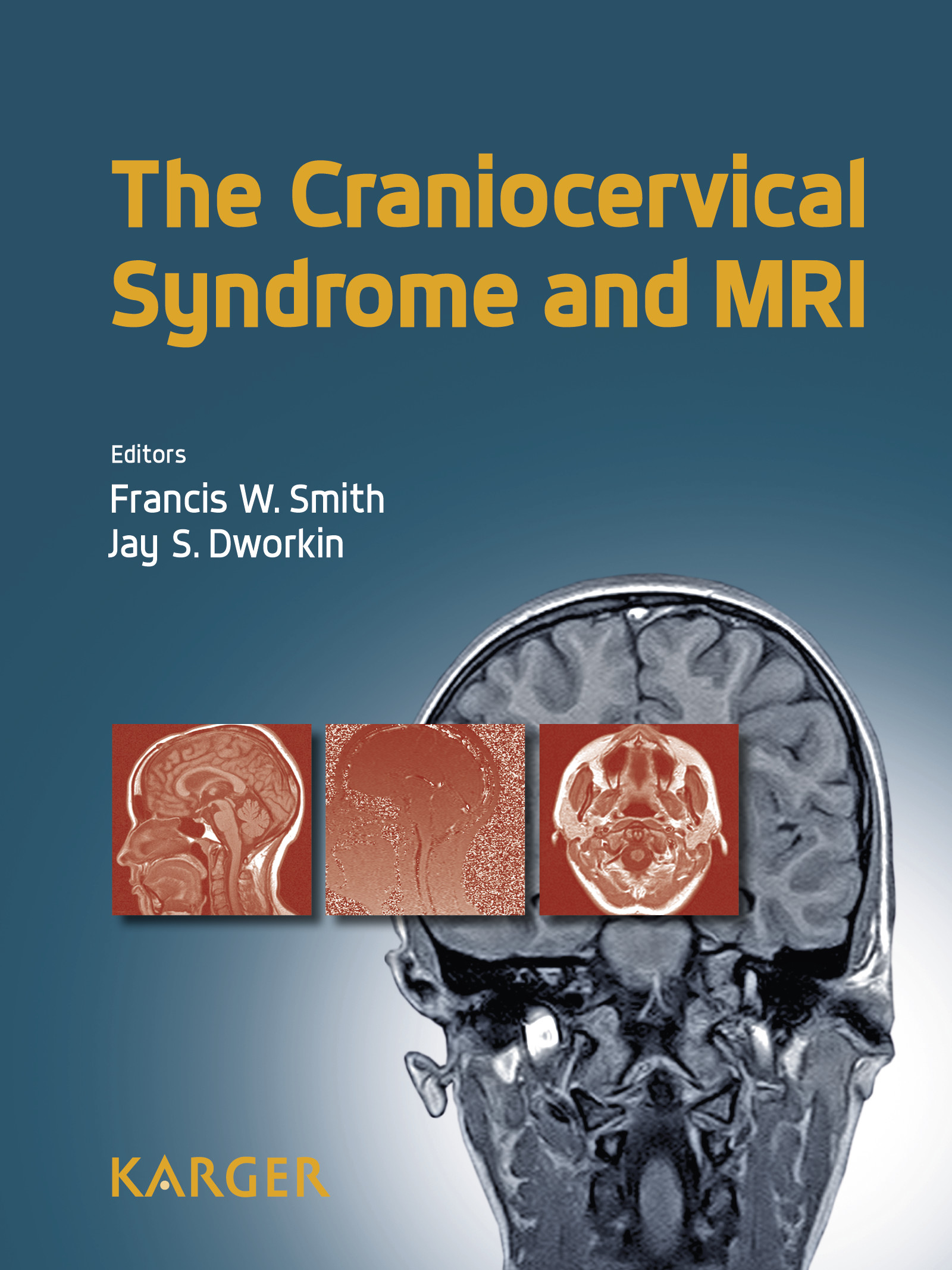 Cover The Craniocervical Syndrome and MRI