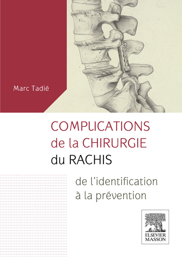 Complications de la chirurgie du rachis