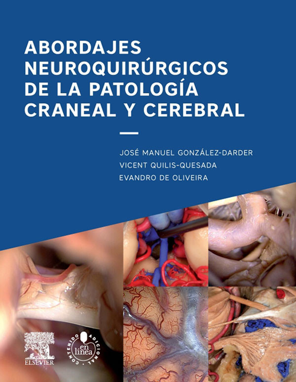 Abordajes neuroquirúrgicos de la patología craneal y cerebral + acceso web