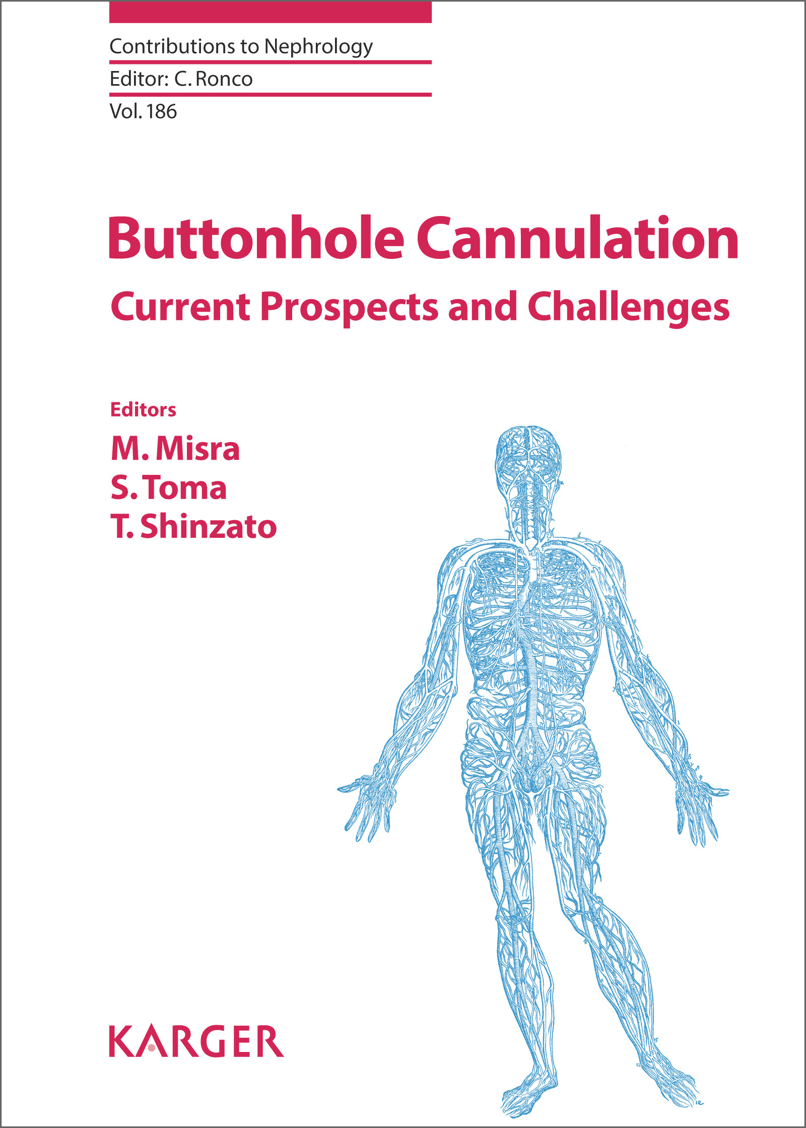 Cover Buttonhole Cannulation
