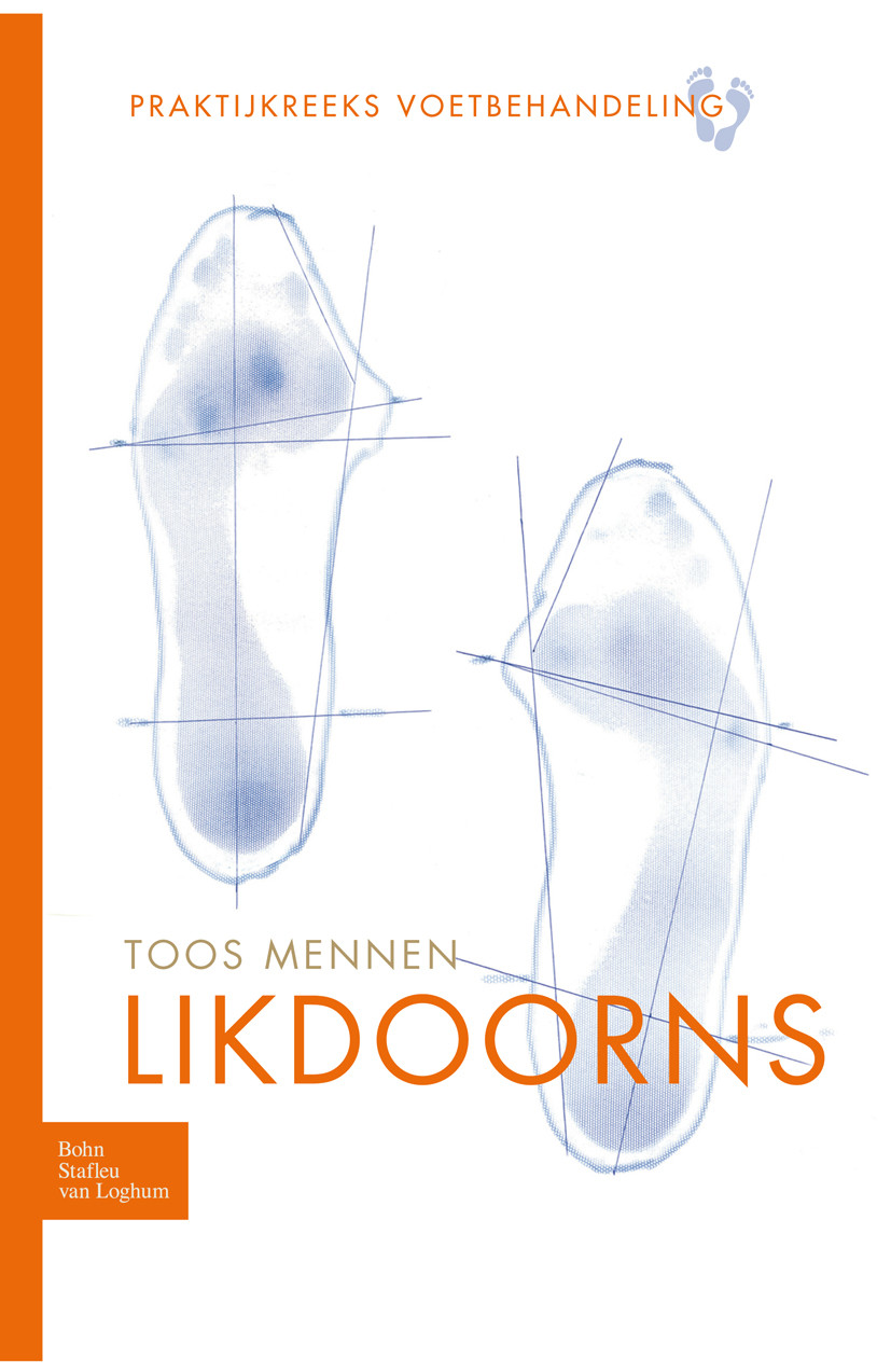 Likdoorns