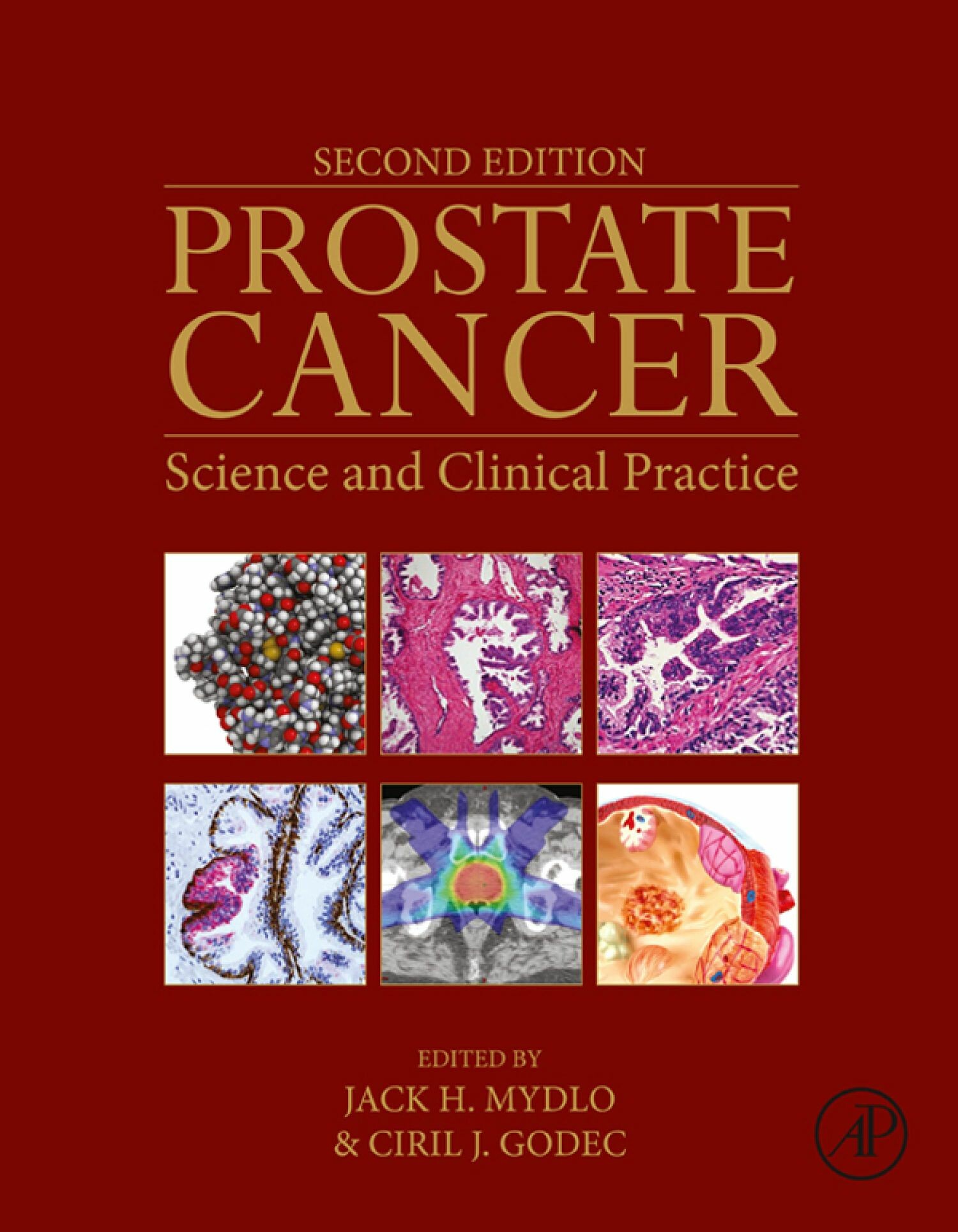 Cover Prostate Cancer