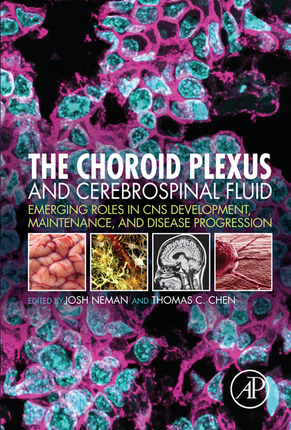 Cover The Choroid Plexus and Cerebrospinal Fluid
