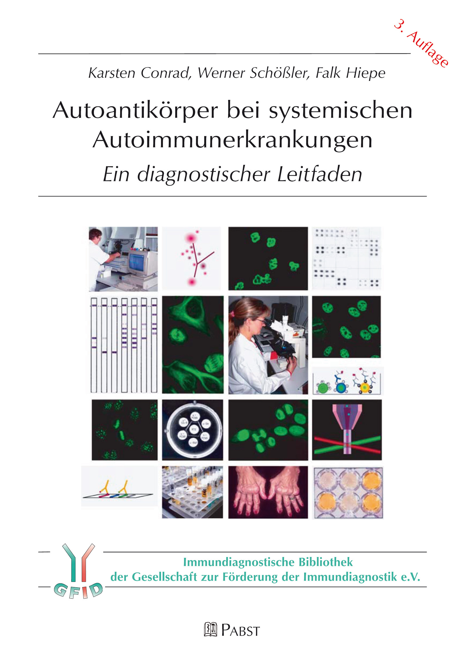 Autoantikörper bei systemischen Autoimmunerkrankungen