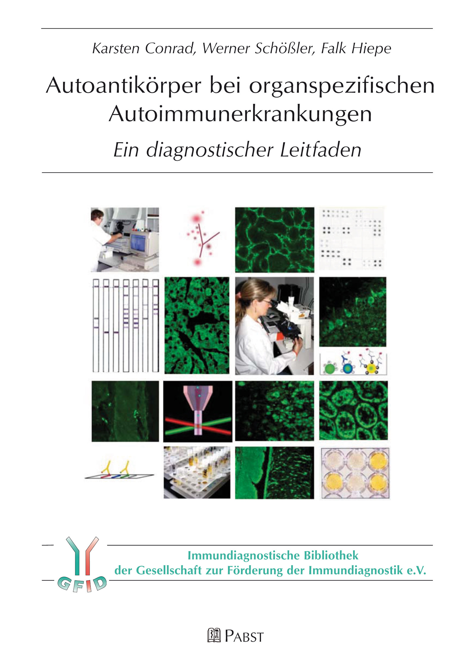 Cover Autoantikörper bei organspezifischen Autoimmunerkrankungen