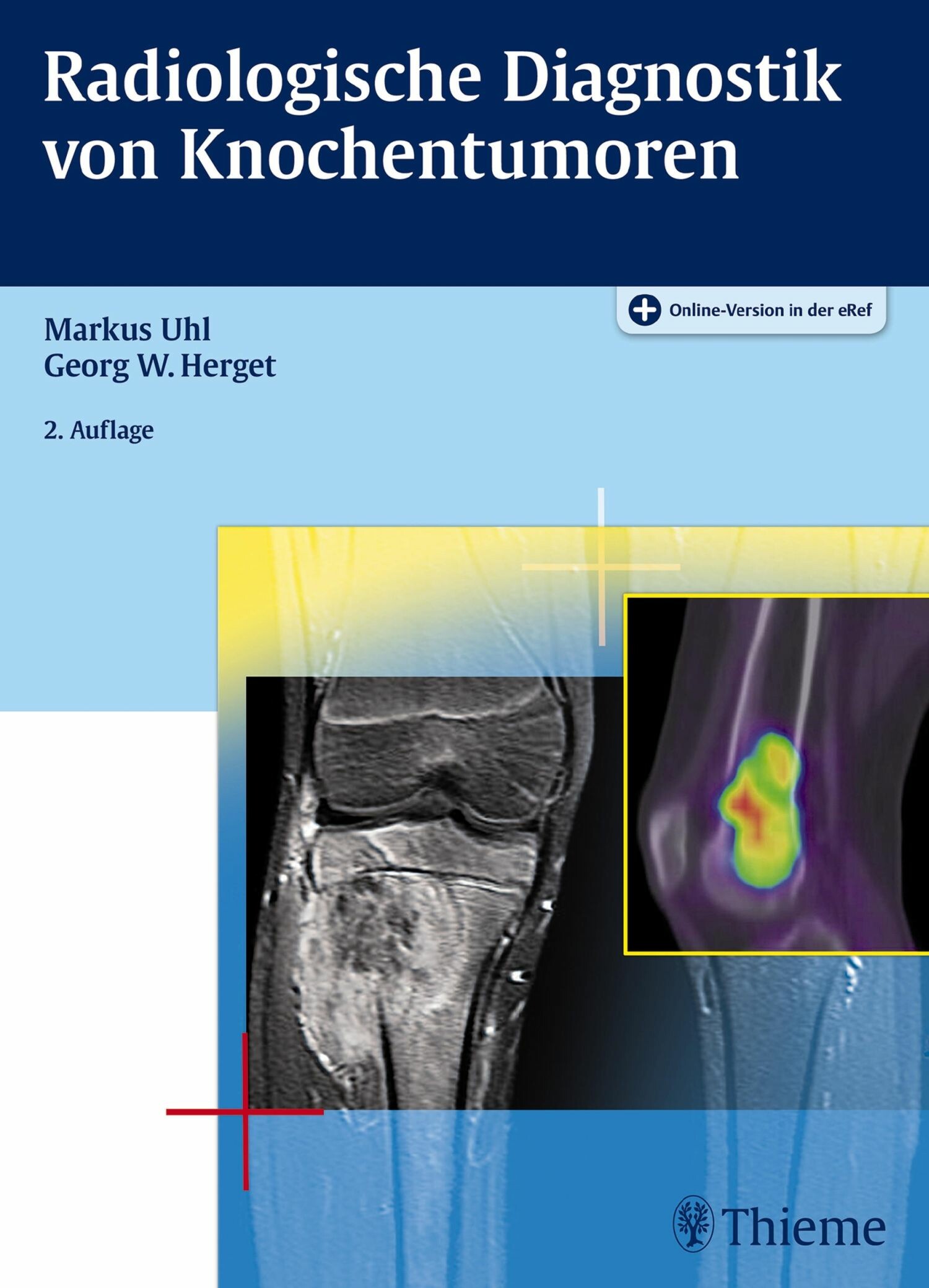 Radiologische Diagnostik von Knochentumoren - E-Book
