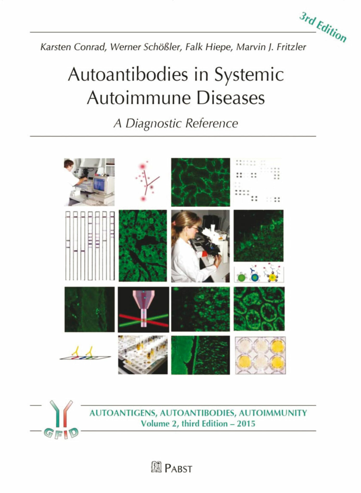 Autoantibodies in Systemic Autoimmune Diseases