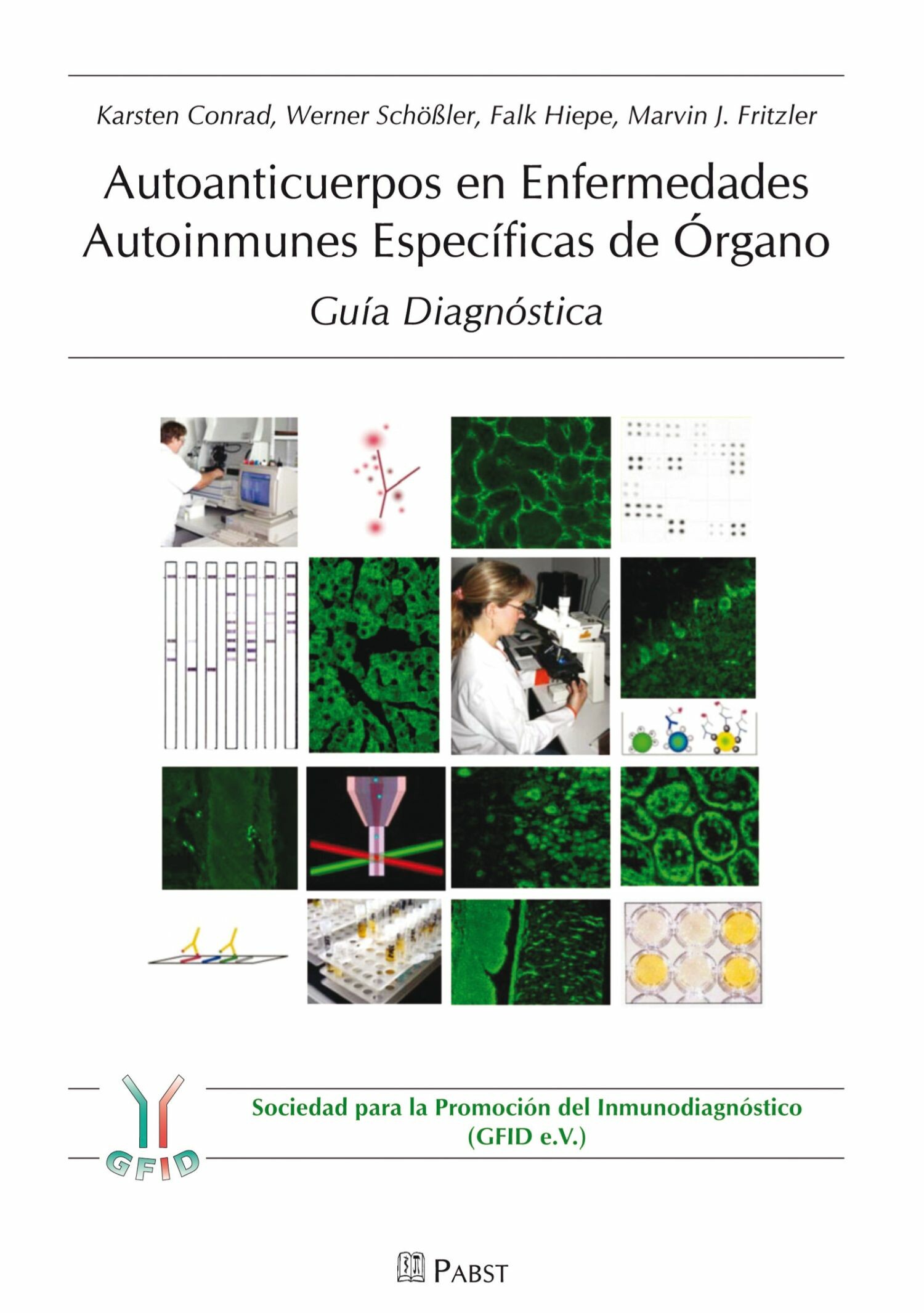 Cover Autoanticuerpos en Enfermedades Autoinmunes Específicas de Órgano – Guía Diagnóstica