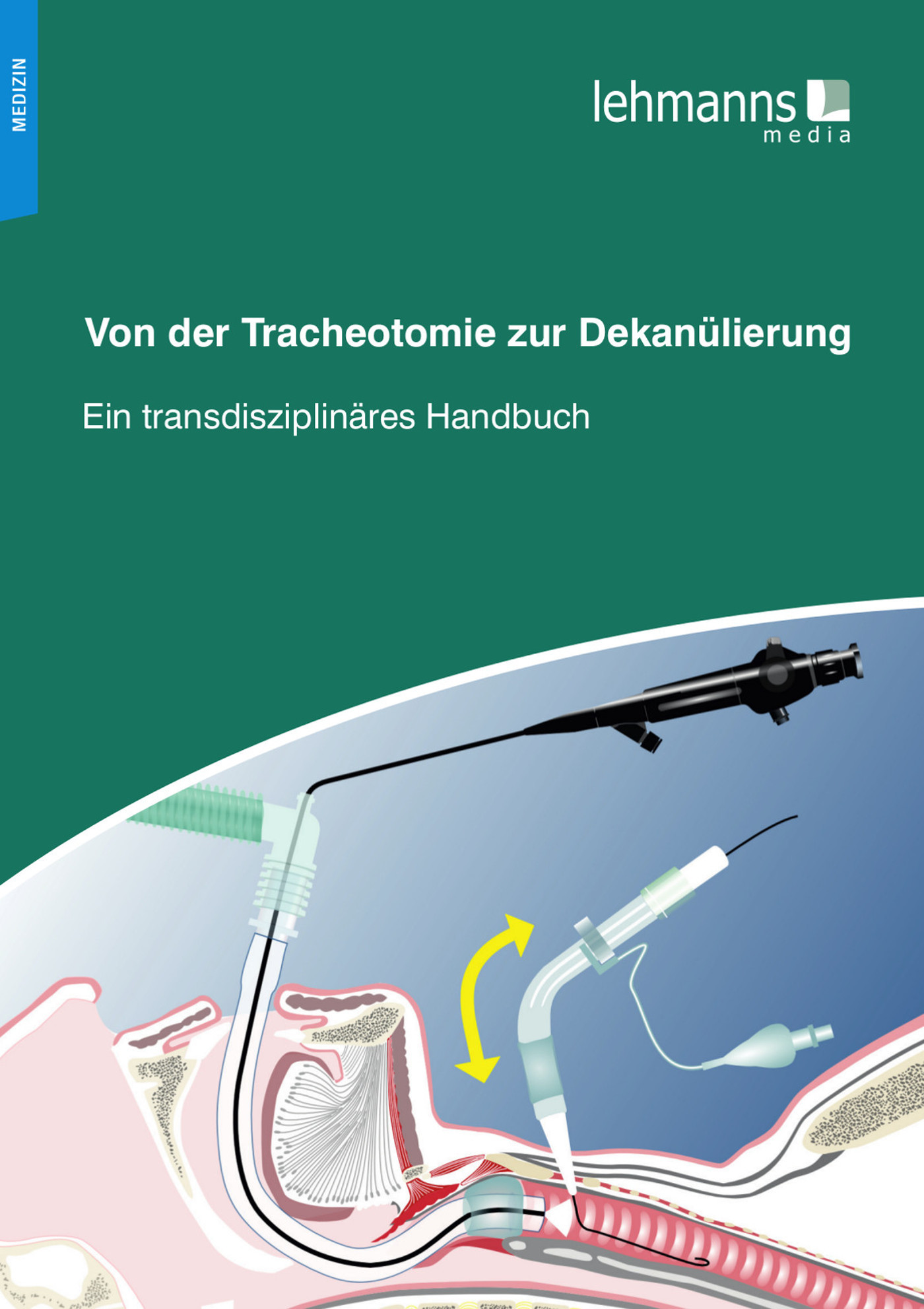 Cover Von der Tracheotomie zur Dekanülierung