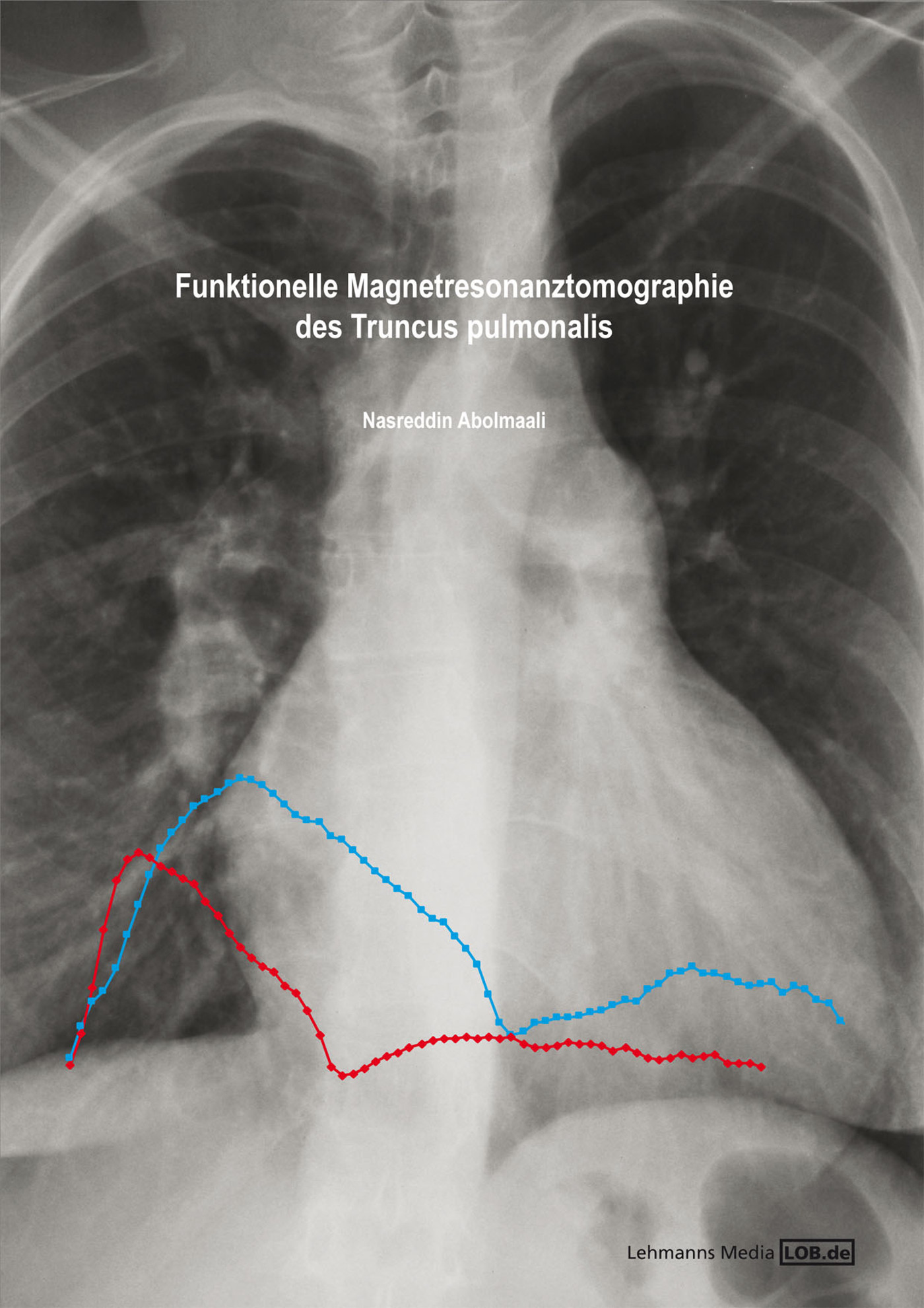 Cover Funktionelle Magnetresonanztomographie des Truncus pulmonalis