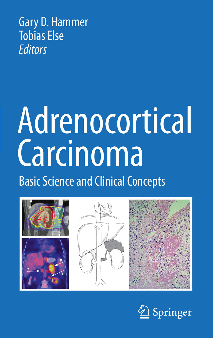 Cover Adrenocortical Carcinoma