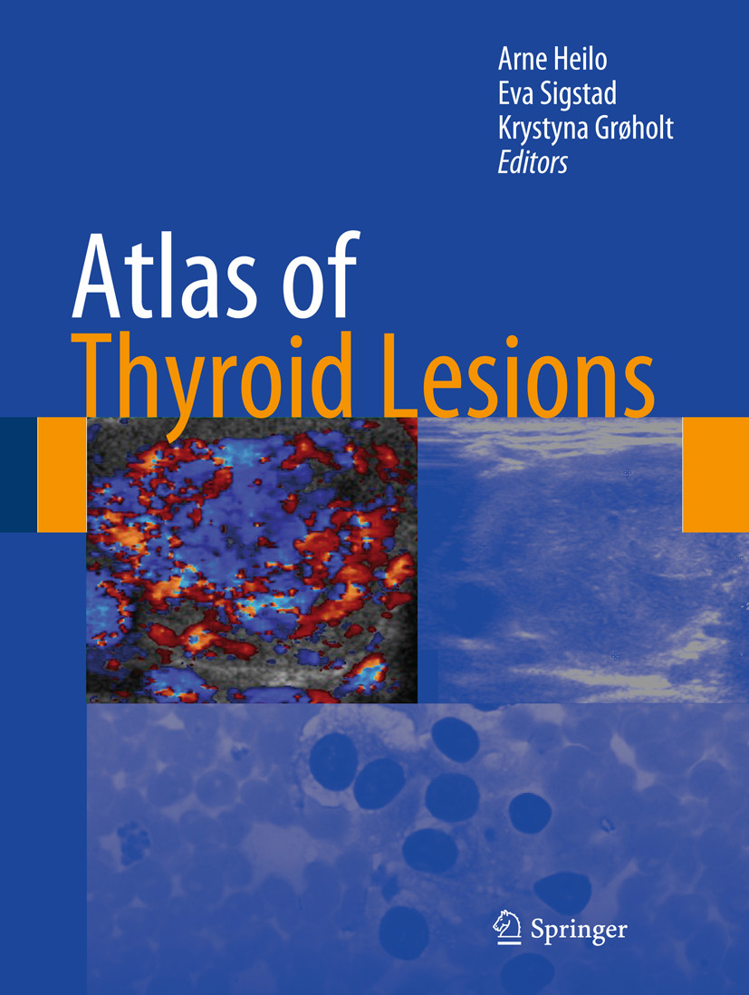 Cover Atlas of Thyroid Lesions