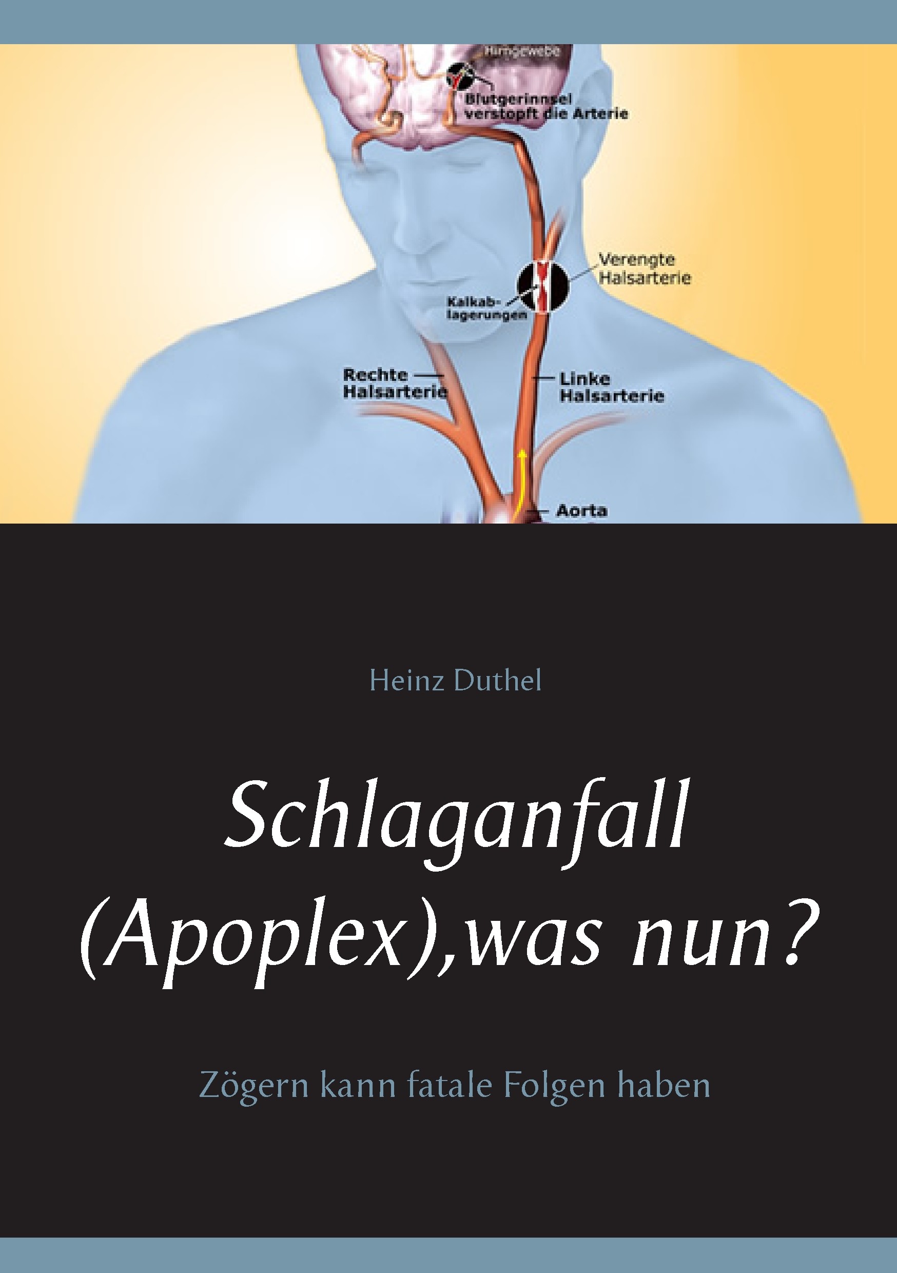 Cover Schlaganfall (Apoplex), was nun?