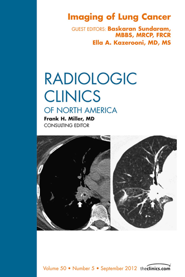 Cover Imaging of Lung Cancer, An Issue of Radiologic Clinics of North America