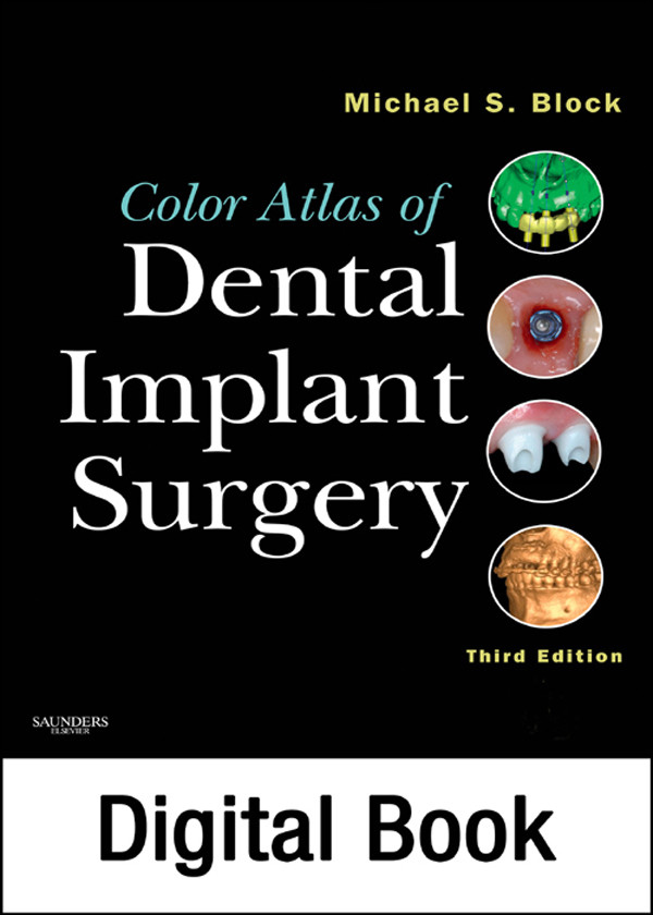 Cover Color Atlas of Dental Implant Surgery - E-Book