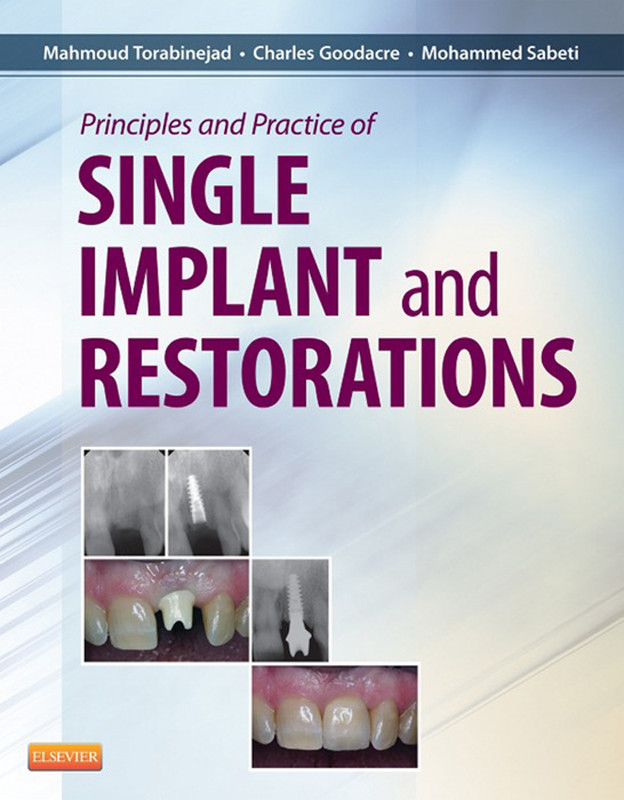 Cover Principles and Practice of Single Implant and Restoration