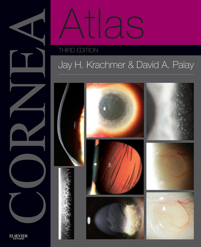 Cover Cornea Atlas