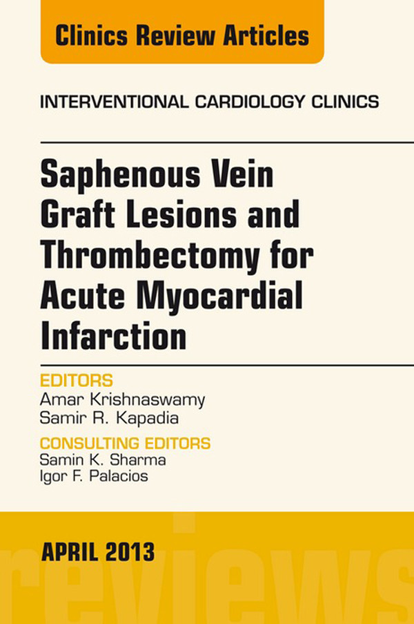 Saphenous Vein Graft Lesions and Thrombectomy for Acute Myocardial Infarction, An Issue of Interventional Cardiology Clinics,