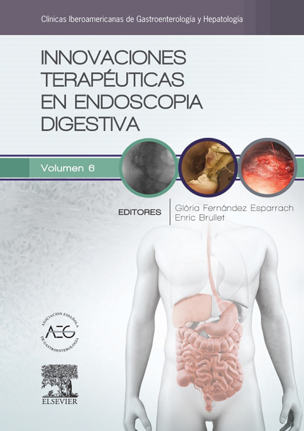 Cover Innovaciones terapéuticas en endoscopia digestiva