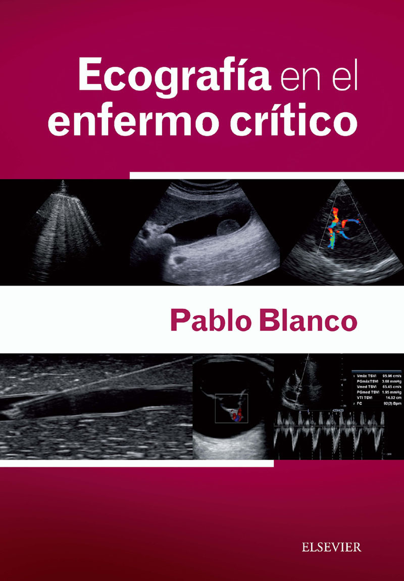 Cover Ecografía en el enfermo crítico + acceso web