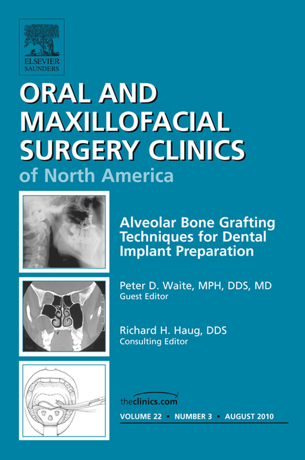 Cover Alveolar Bone Grafting Techniques in Dental Implant Preparation, An Issue of Oral and Maxillofacial Surgery Clinics