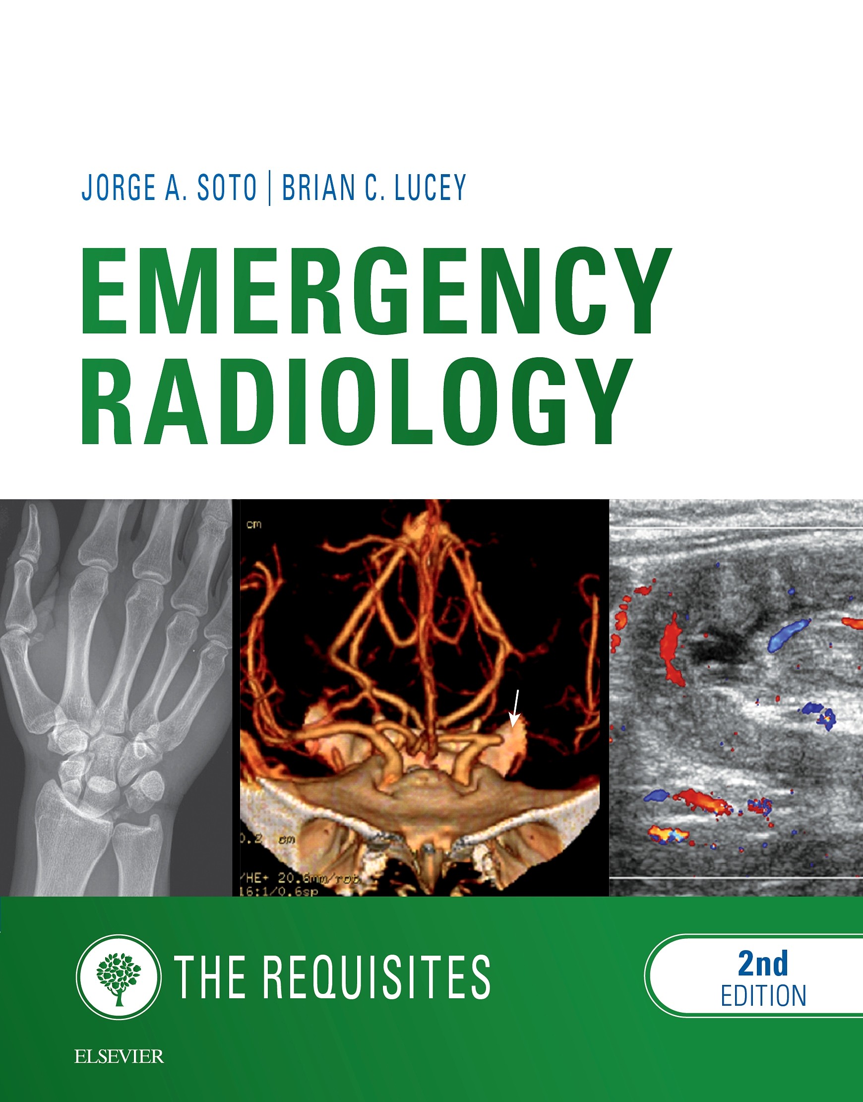 Cover Emergency Radiology: The Requisites