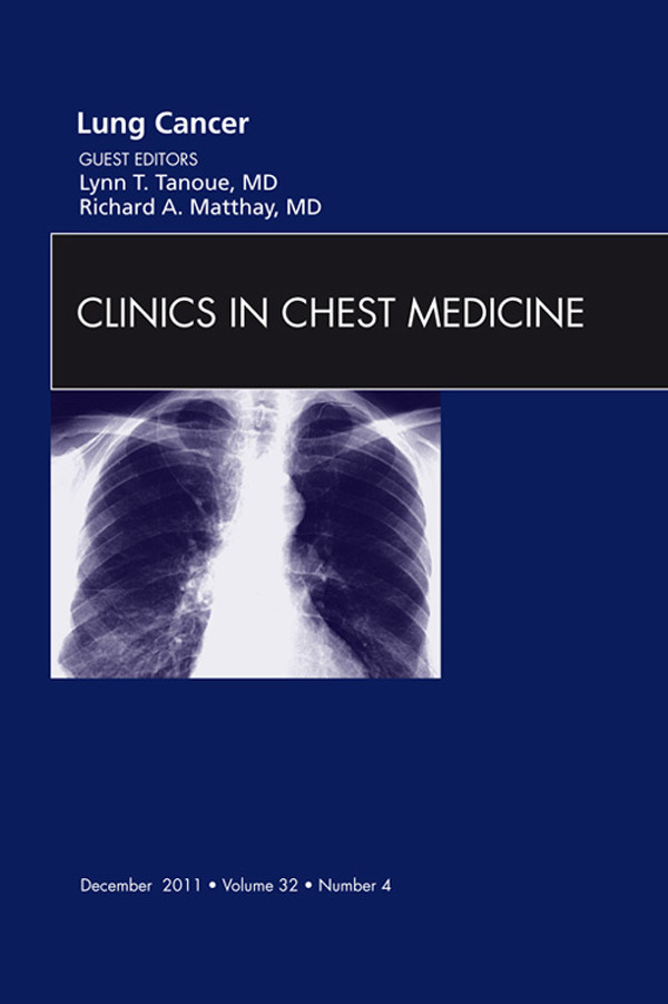 Cover Lung Cancer, An Issue of Clinics in Chest Medicine