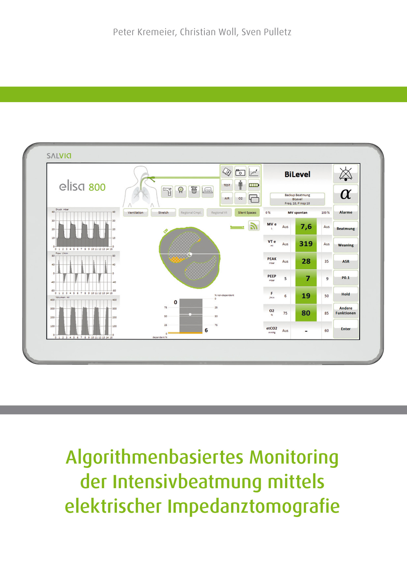 Algorithmenbasiertes Monitoring der Intensivbeatmung mittels elektrischer Impedanztomografie